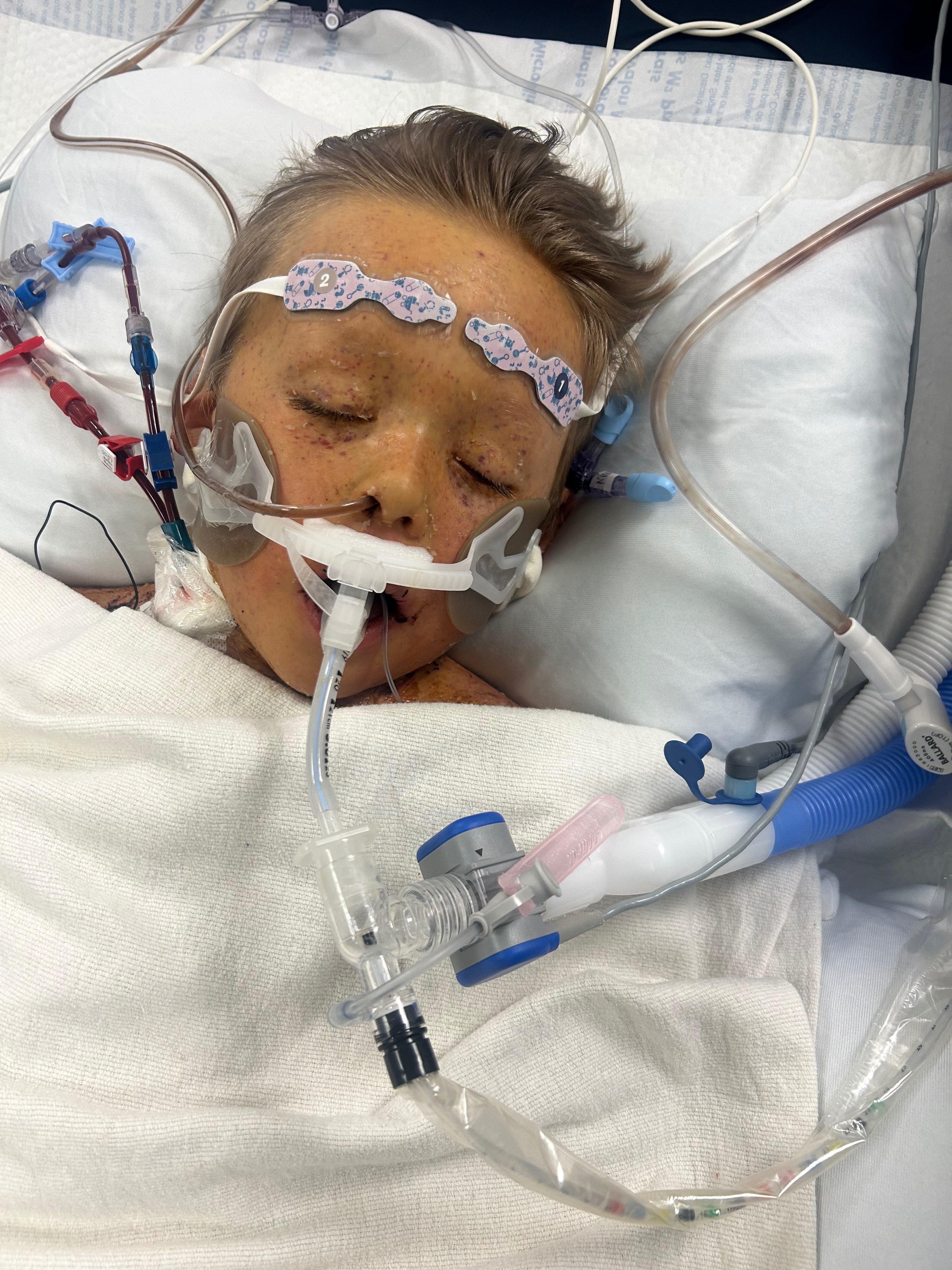 Help Blue Fight Life-Threatening Sepsis campaign photo, 2 of 7