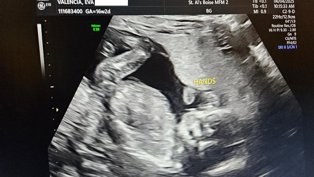 Support Eva's Life-Saving Pregnancy Needs photo