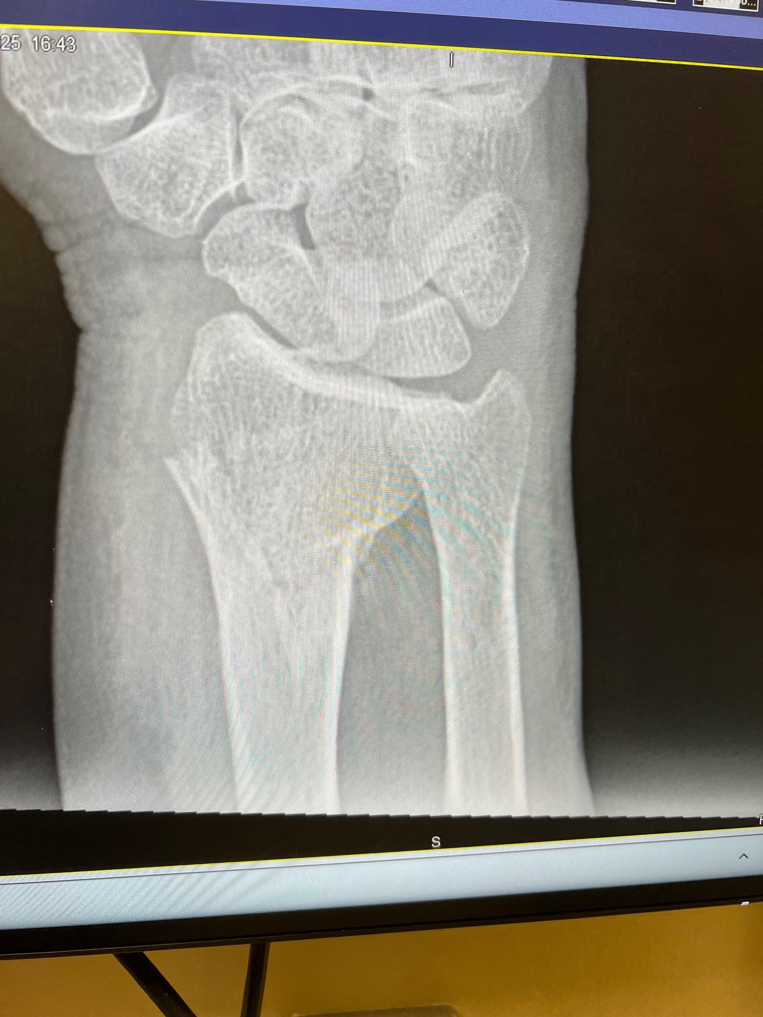 Rally for Mom's Wrist Surgery Costs campaign photo, 4 of 6