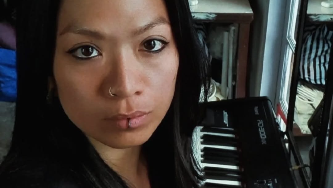 Help Fiona Recover from a Life-Altering Accident photo