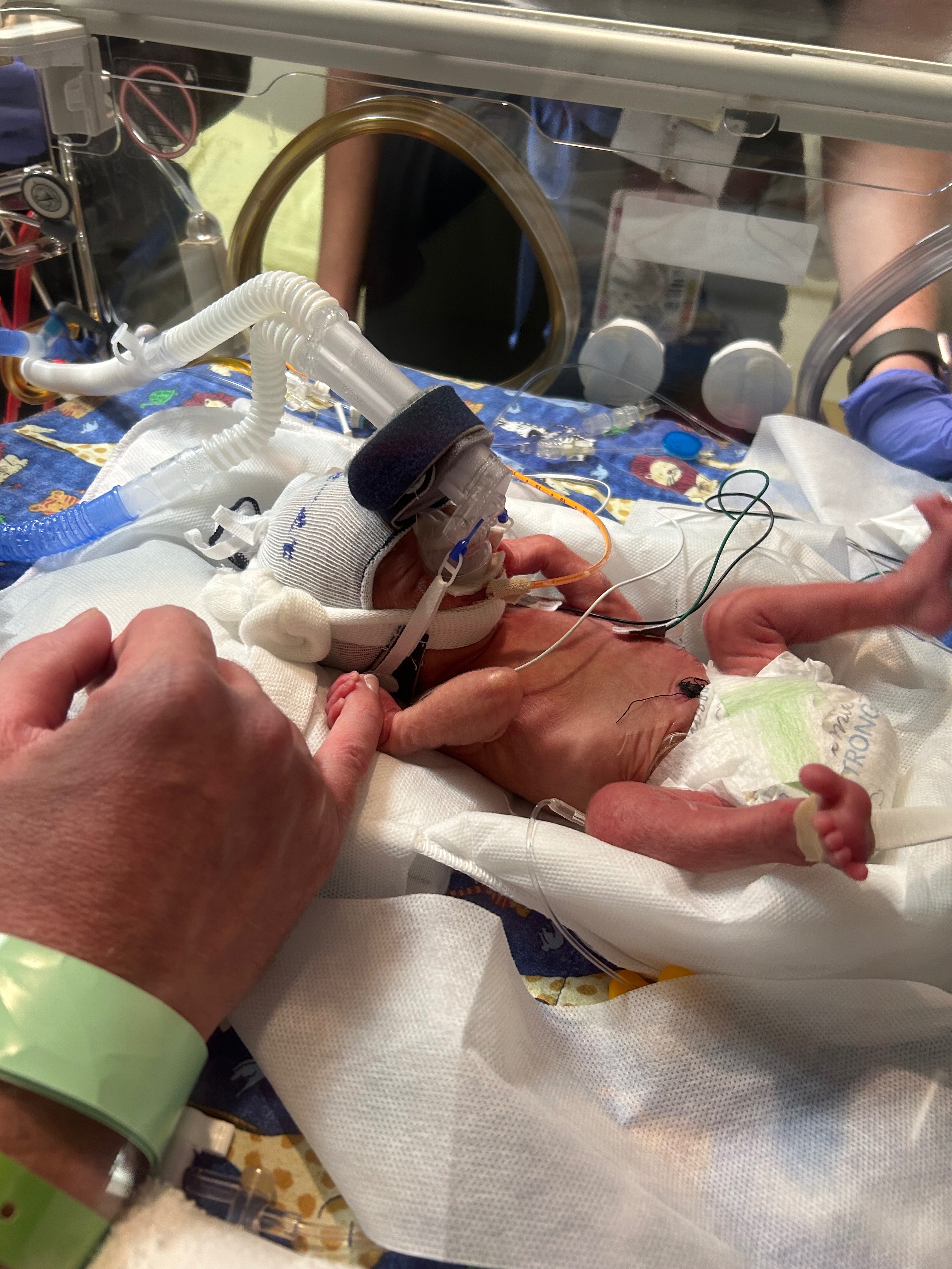 Help Jamie and Ryan’s Twins Fight for Their Lives campaign photo, 4 of 7
