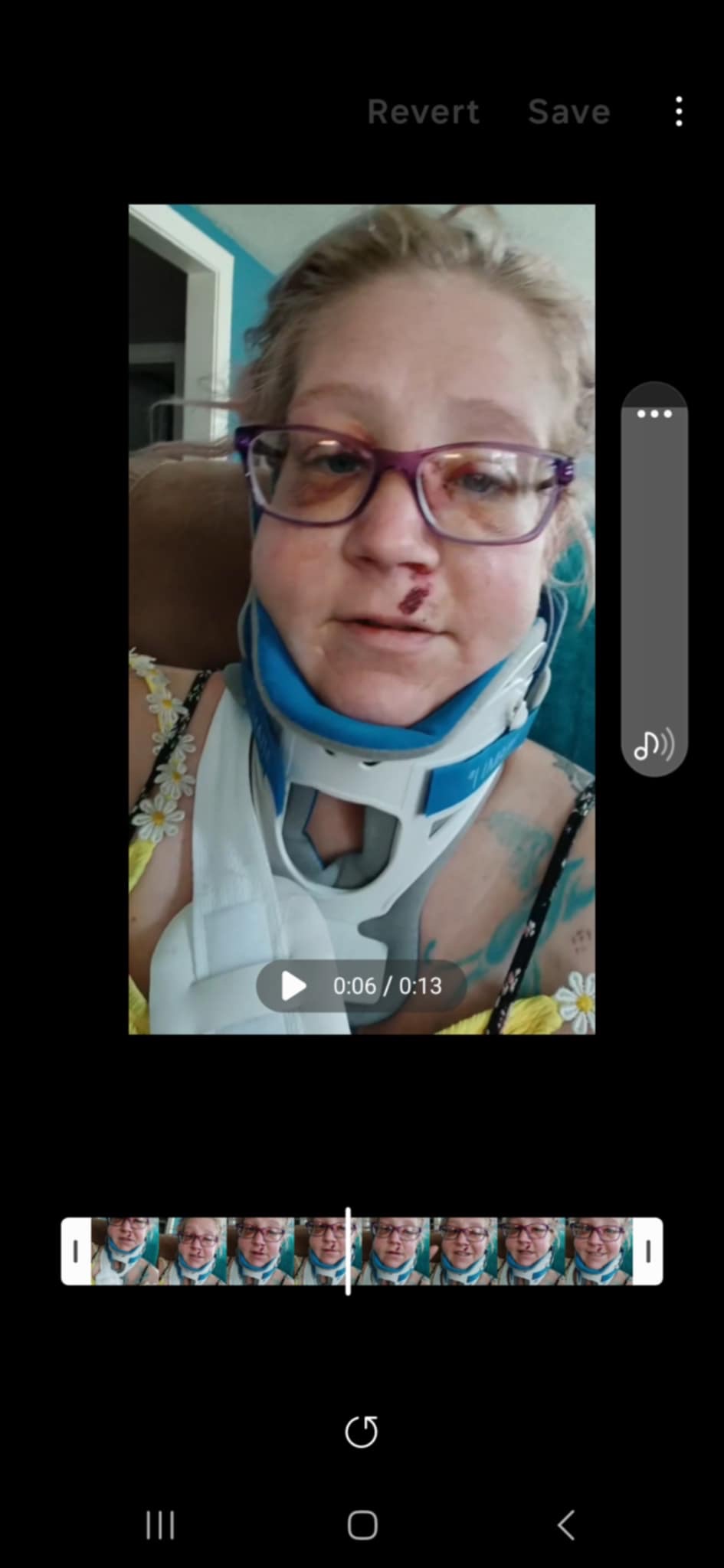 Support Kassy After Her Accident campaign photo, 6 of 8