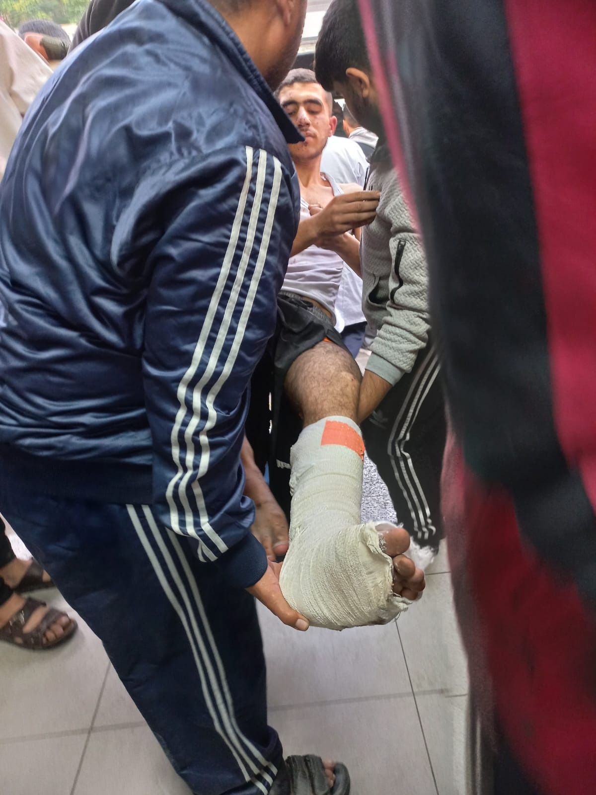 Foto de la campaña "Help Mohammed Survive in Gaza – Injured, Hungry, and Trappe, 4 de 5