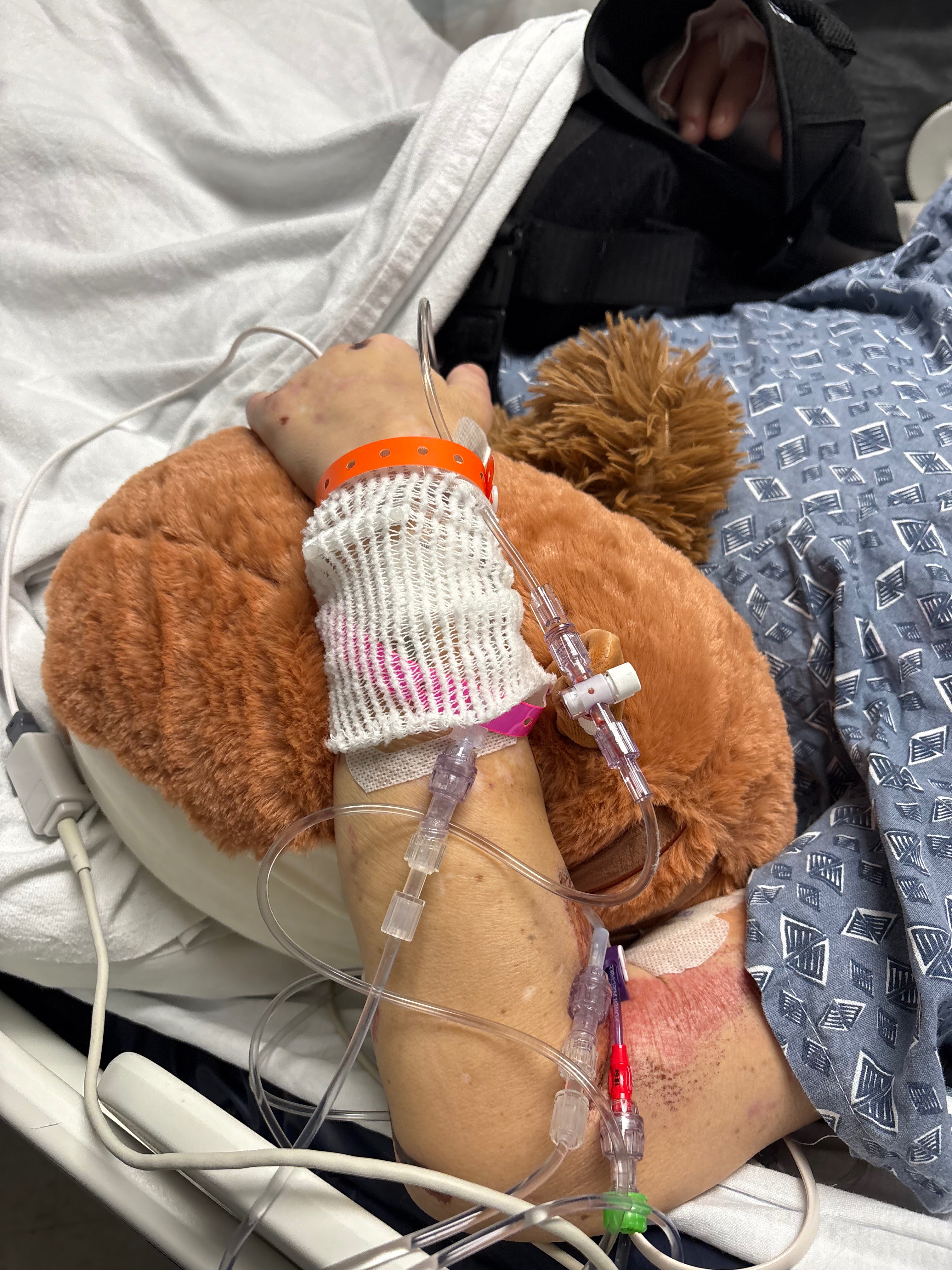 Support Ambers Recovery at Home after Hit and Run! campaign photo, 6 of 7