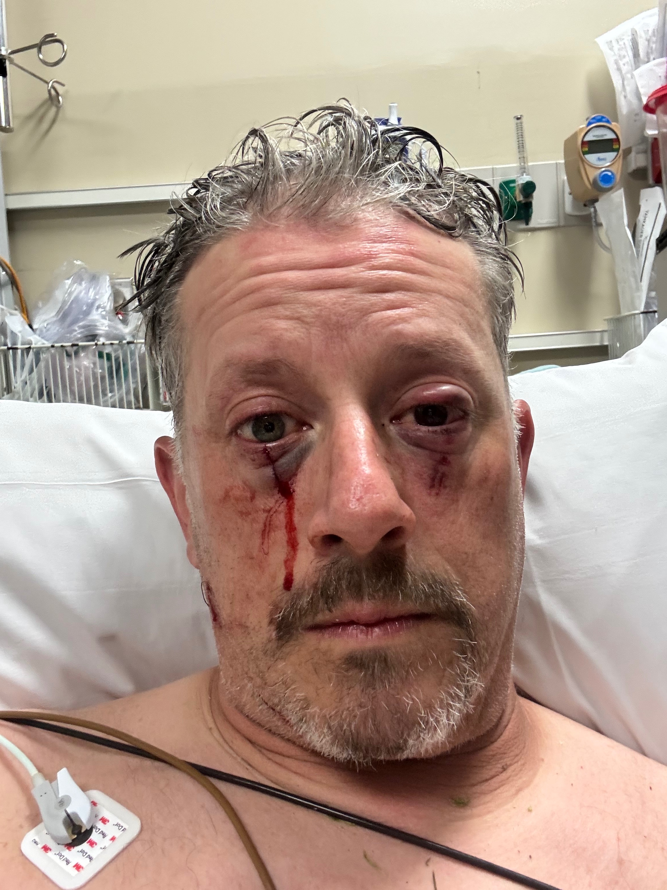 Support Mark Dambek's Eye Injury Recovery campaign photo, 2 of 6