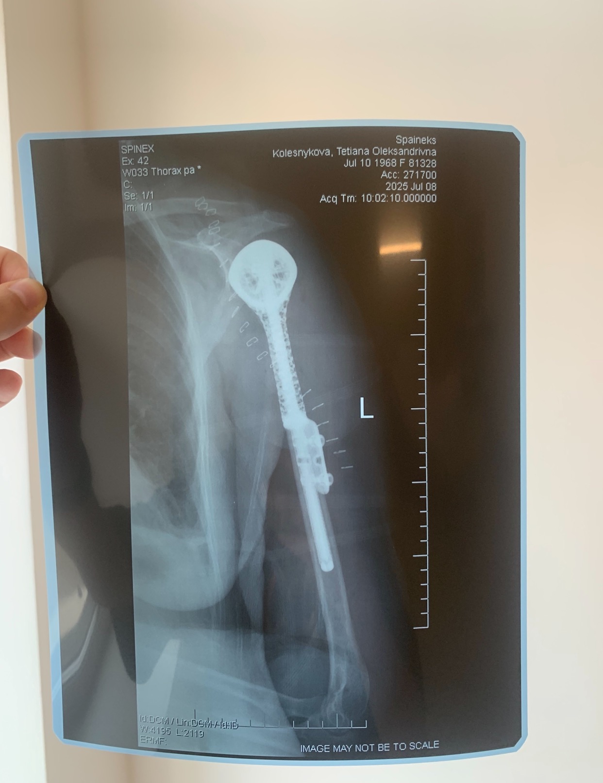 Help My Mom Fight Rare Bone Cancer campaign photo, 4 of 7