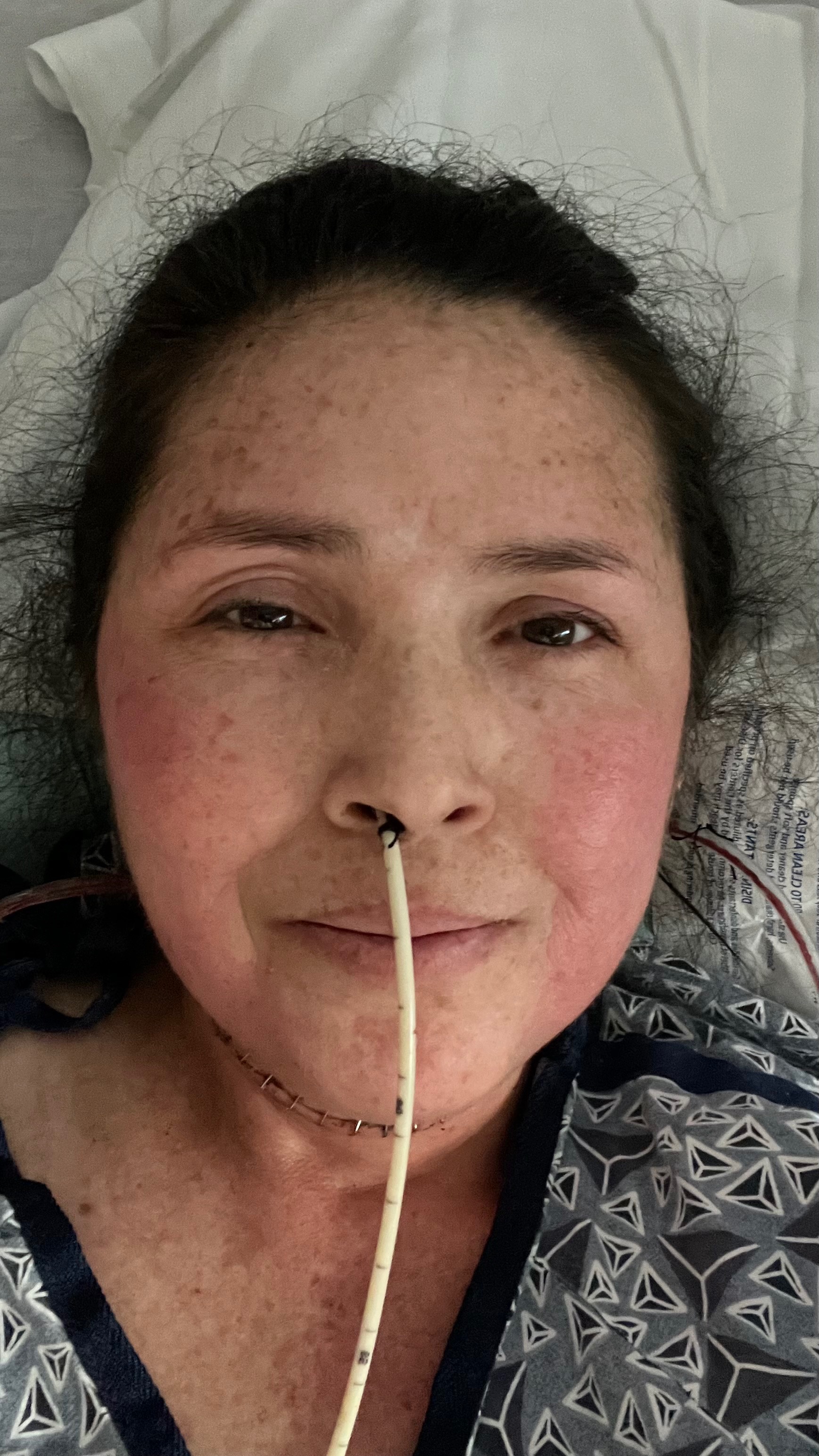 Support Otilia Patricia's Battle Against Tongue Cancer campaign photo, 2 of 7