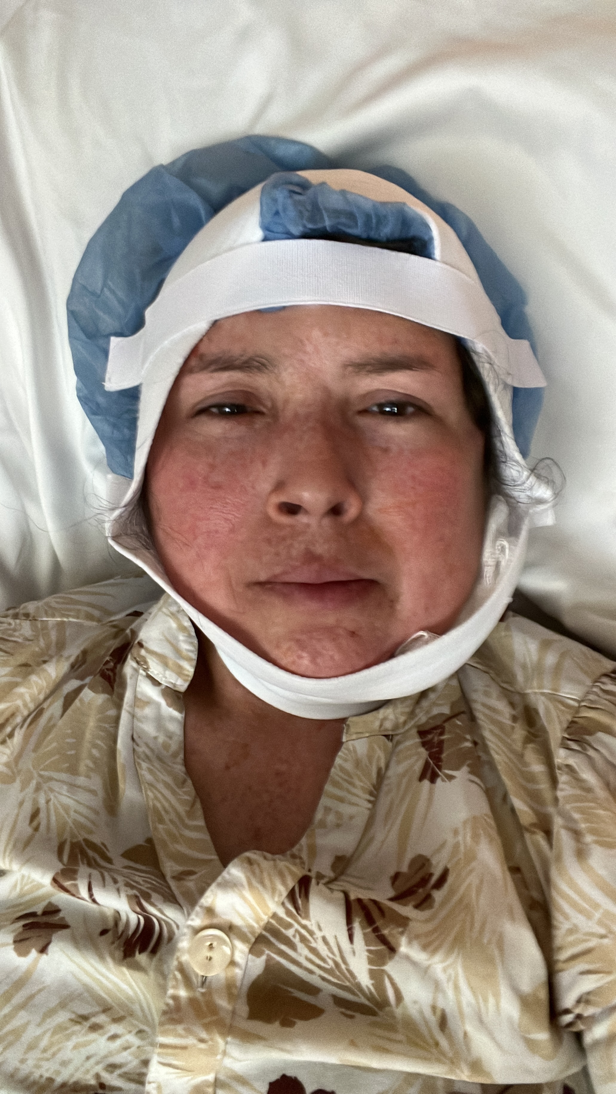 Support Otilia Patricia's Battle Against Tongue Cancer campaign photo, 4 of 7