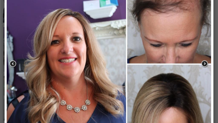 Fun Raisor Hair Fundraiser by Alison Corder : Donations for a new Hair Integration ...