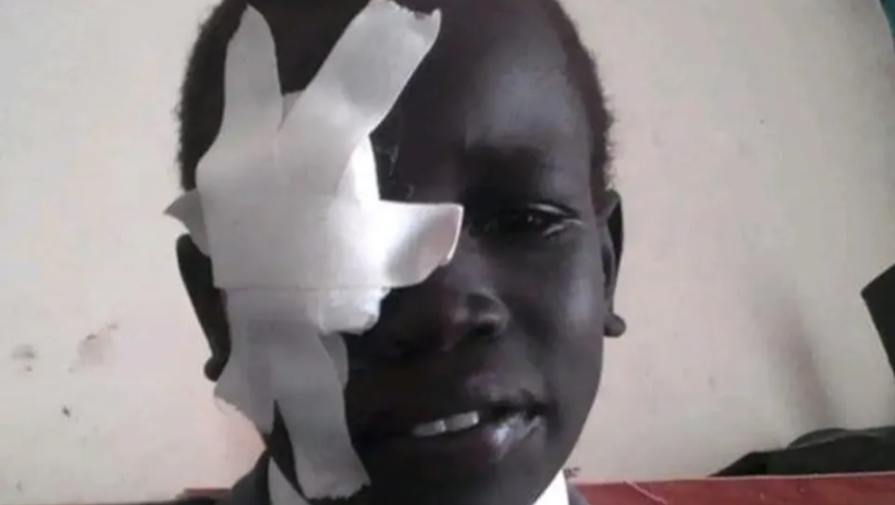 Help Malik Get a Prosthetic Eye photo