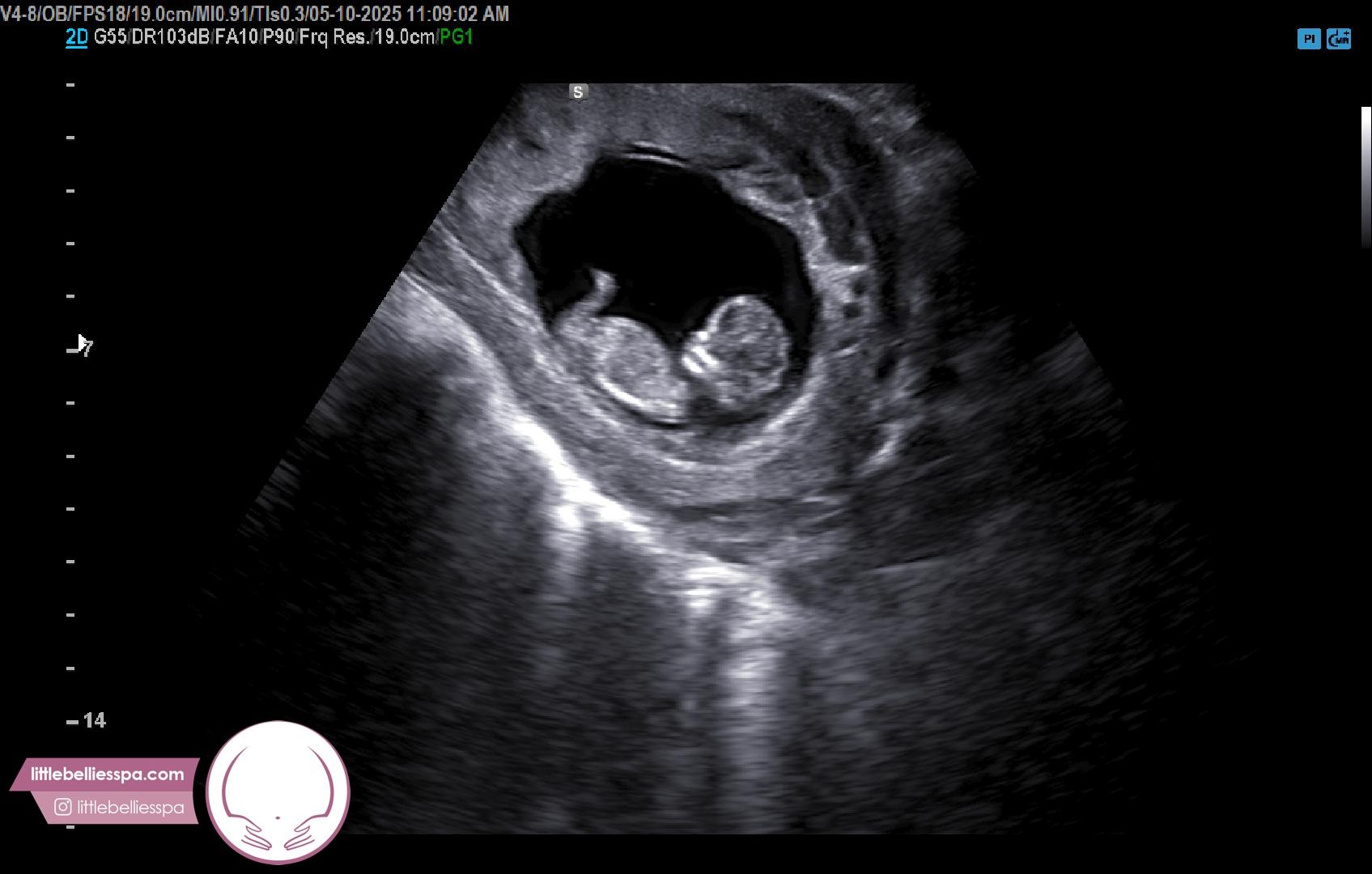 Baby Bey Has Arrived! Thank You To Our Supporters!! campaign photo, 2 of 4