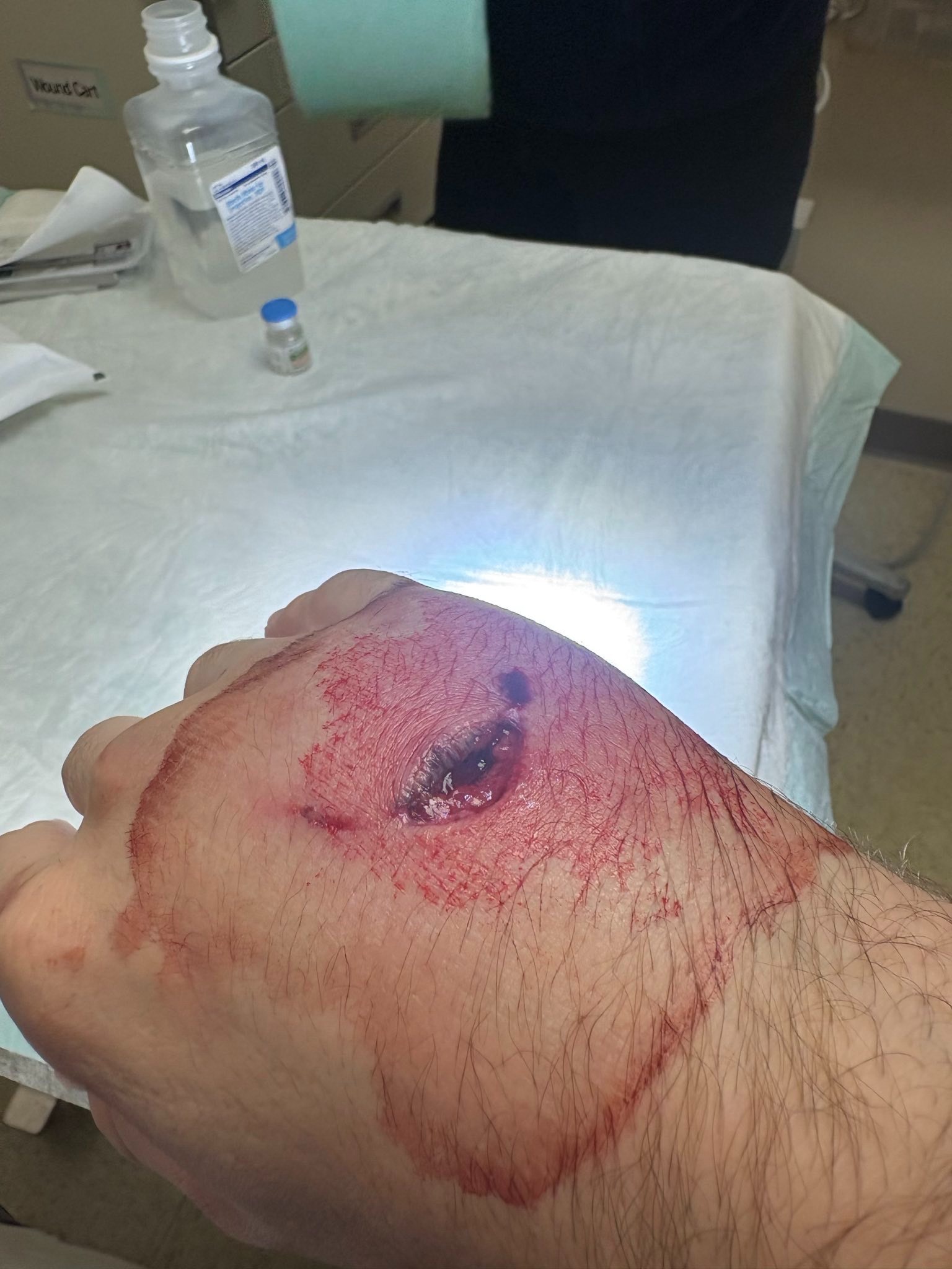 Anti-ICE Protestor Shot by LAPD campaign photo, 5 of 6