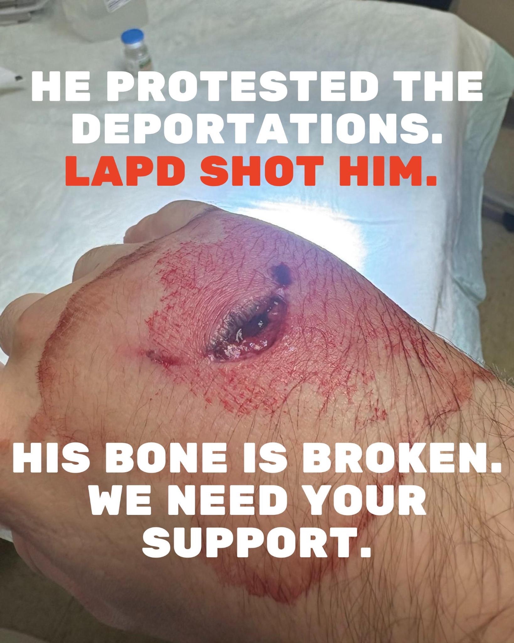 Anti-ICE Protestor Shot by LAPD campaign photo, 4 of 6