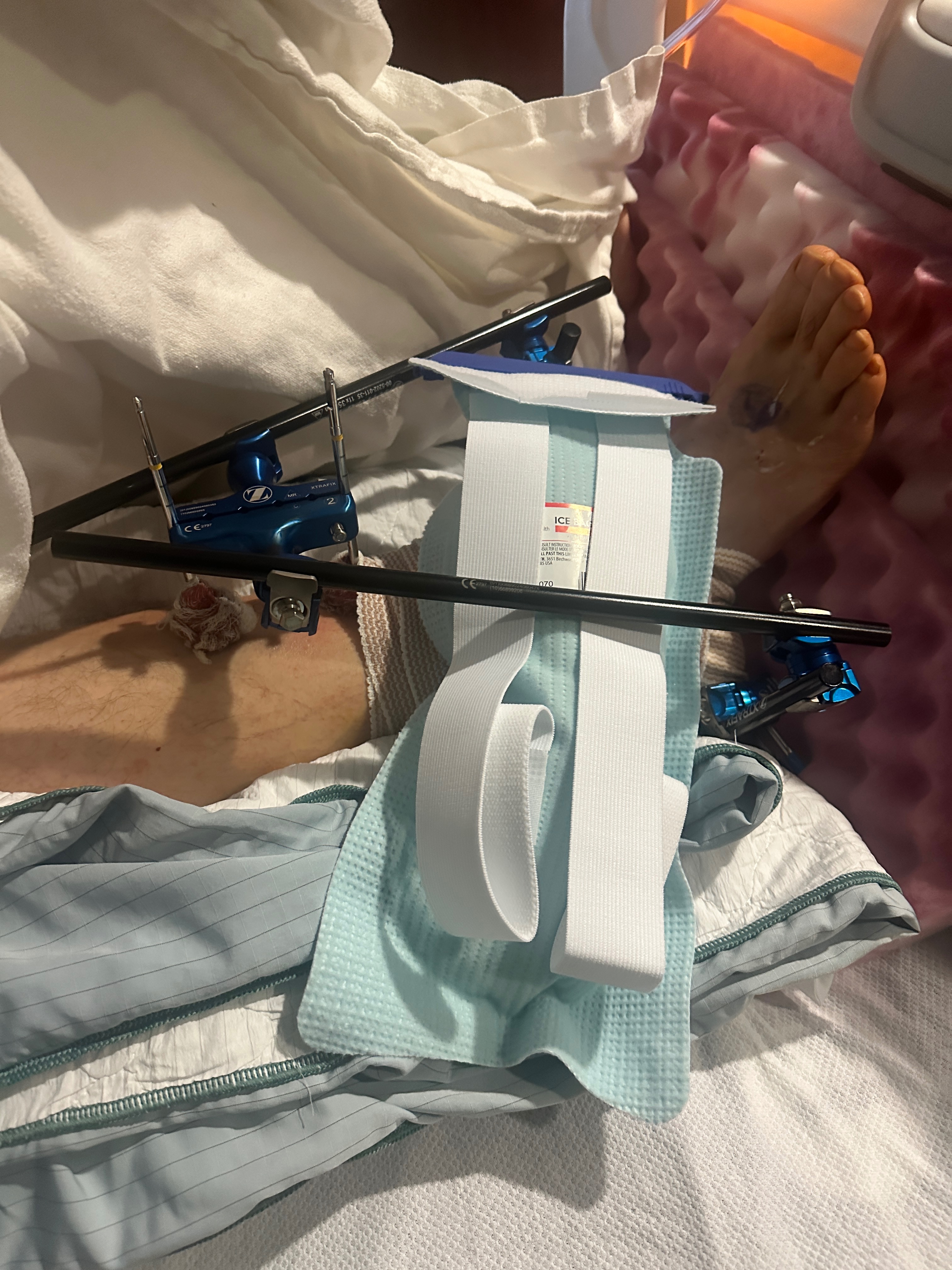Help Greg Stentz After Devastating Accident campaign photo, 5 of 8