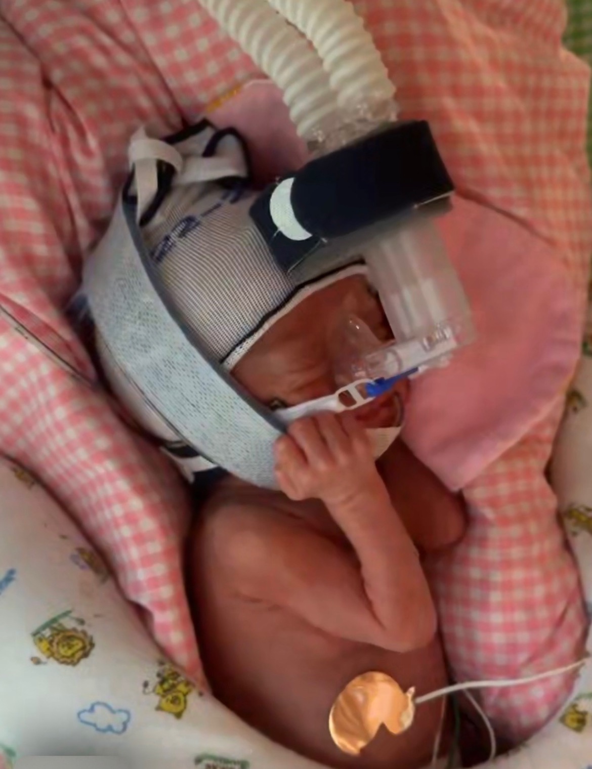 UPDATE: Parker's NICU Journey campaign photo, 7 of 8