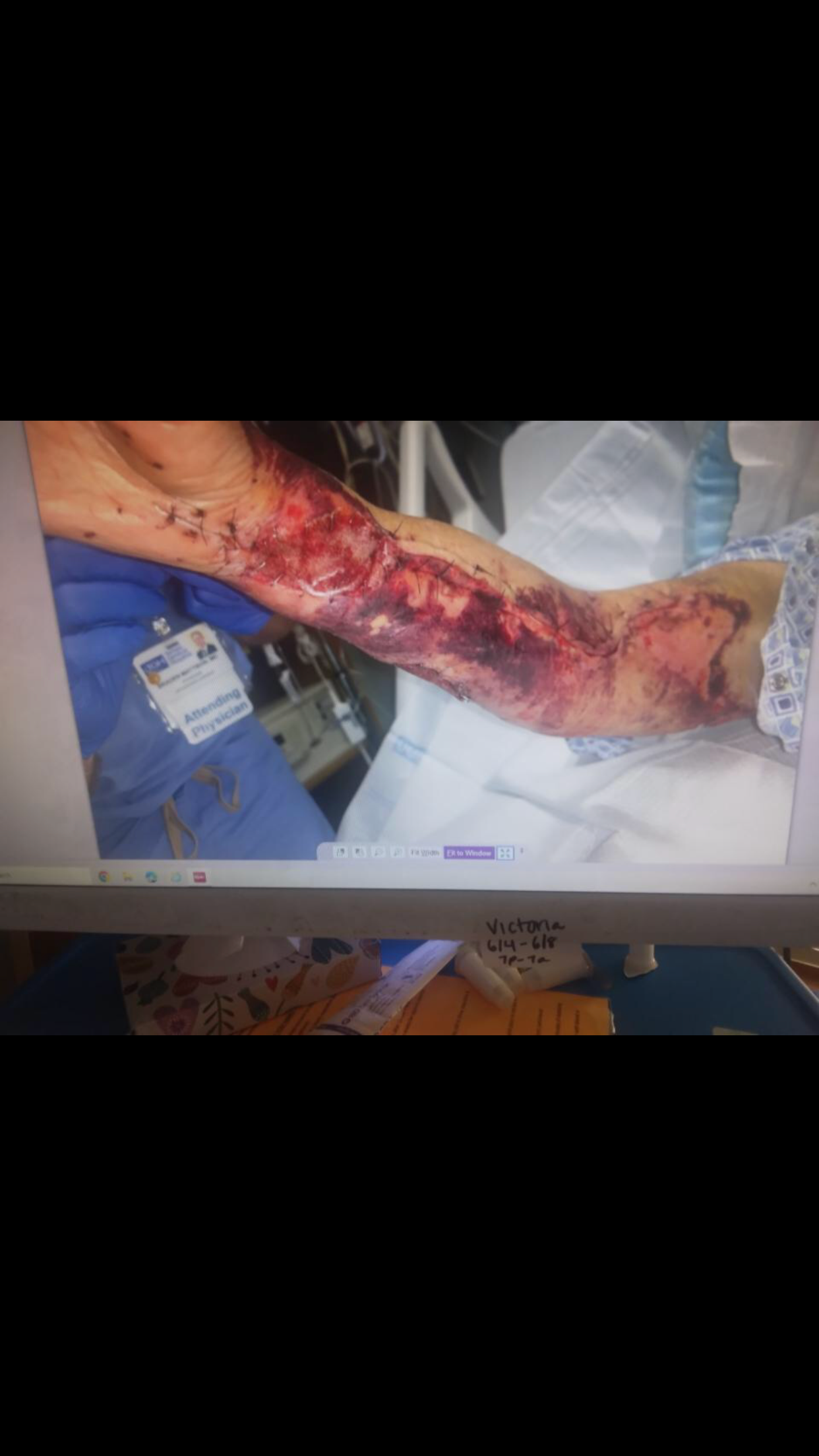 Michele's Road to Recovery campaign photo, 2 of 7