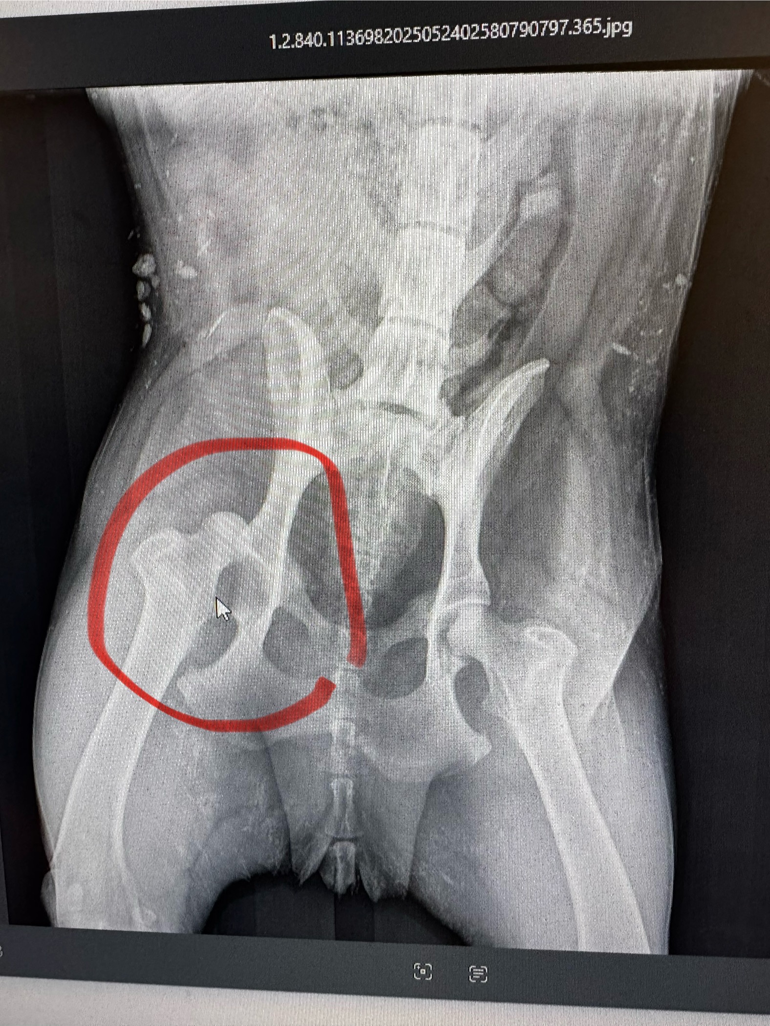 Support Thea's Recovery After Severe Accident campaign photo, 2 of 4