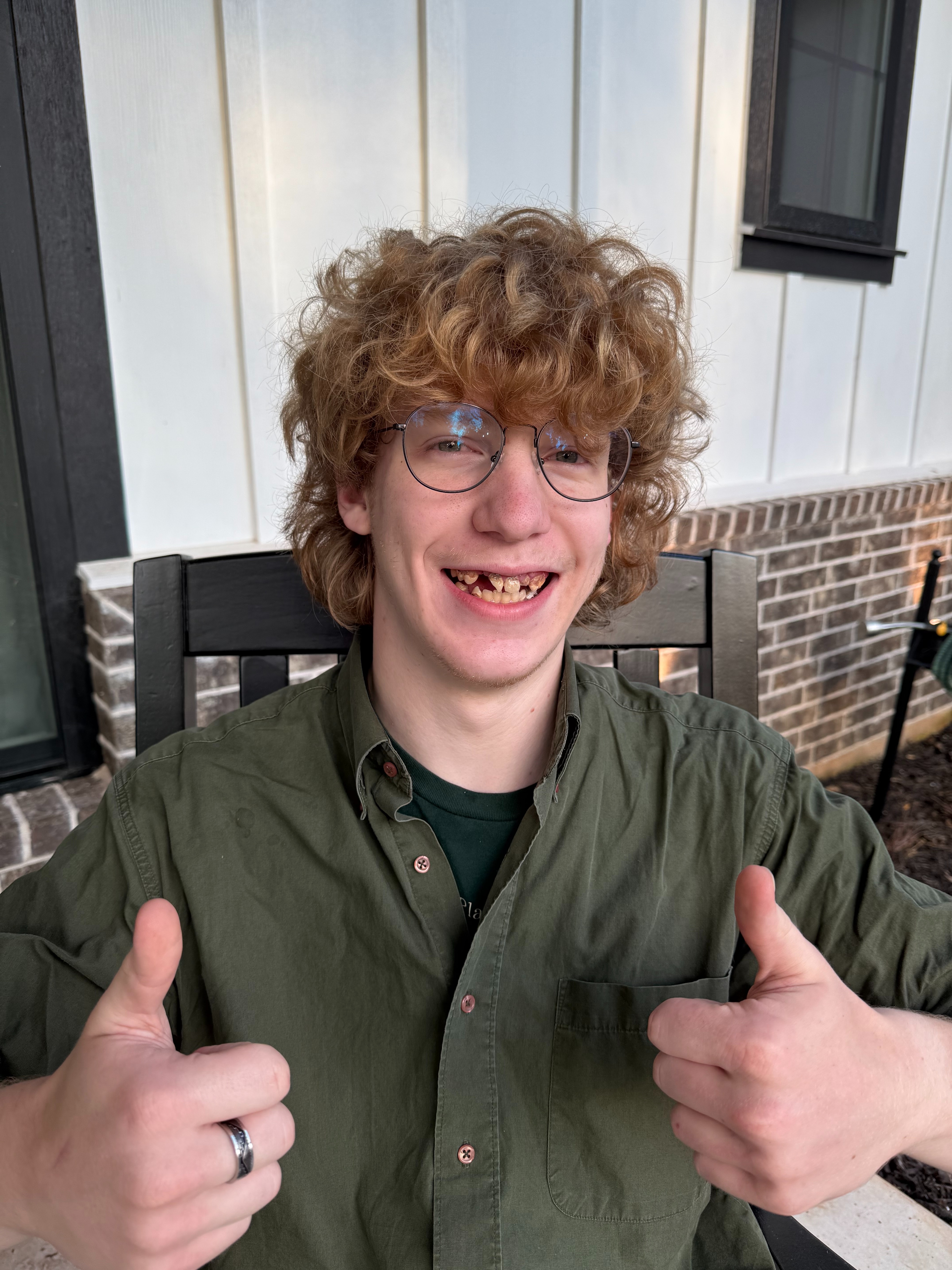 Help Seth Overcome His Dental Challenges campaign photo, 2 of 4