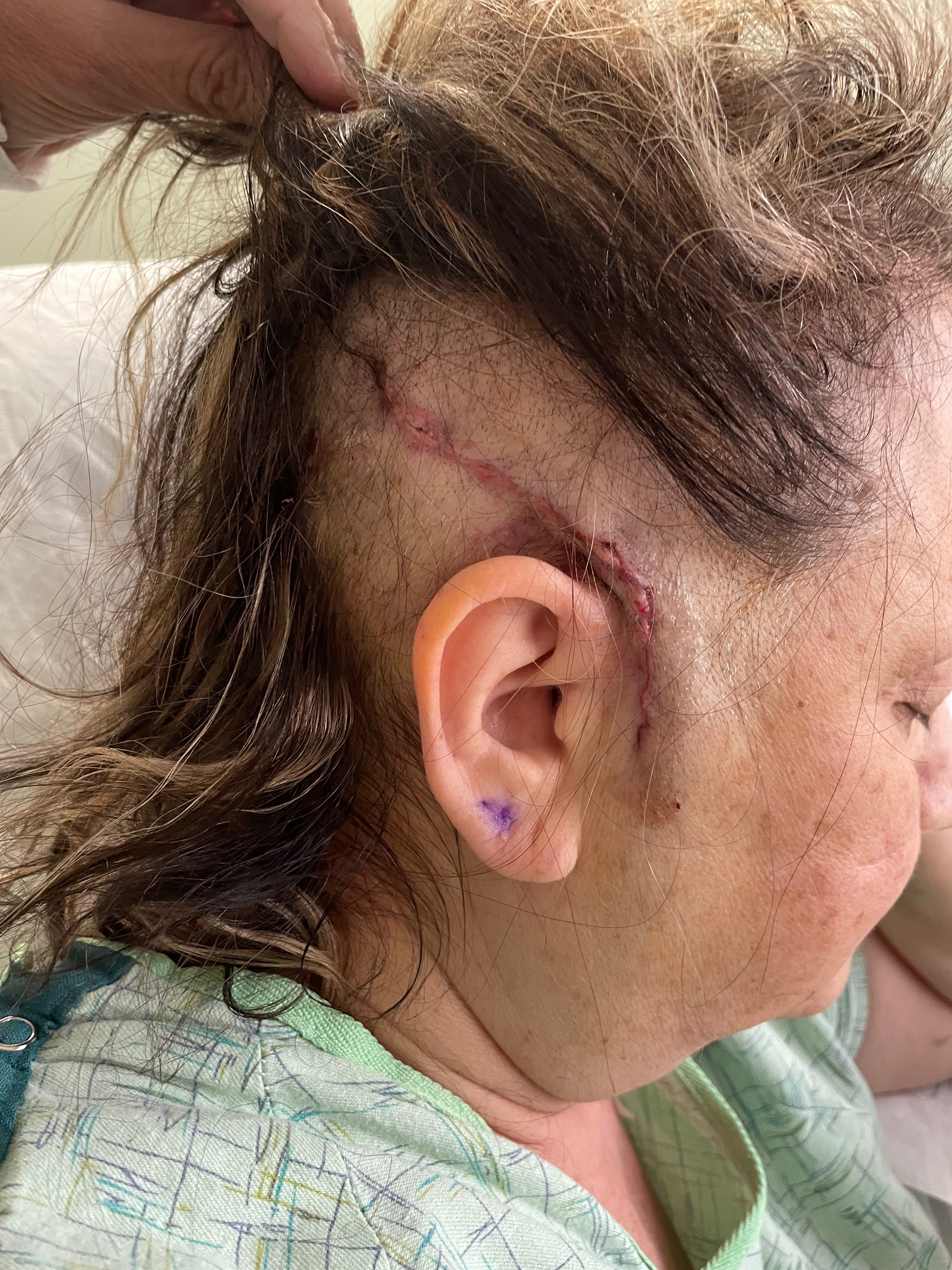 Donate to Donna Whalen's Recovery and Financial Stability campaign photo, 2 of 4