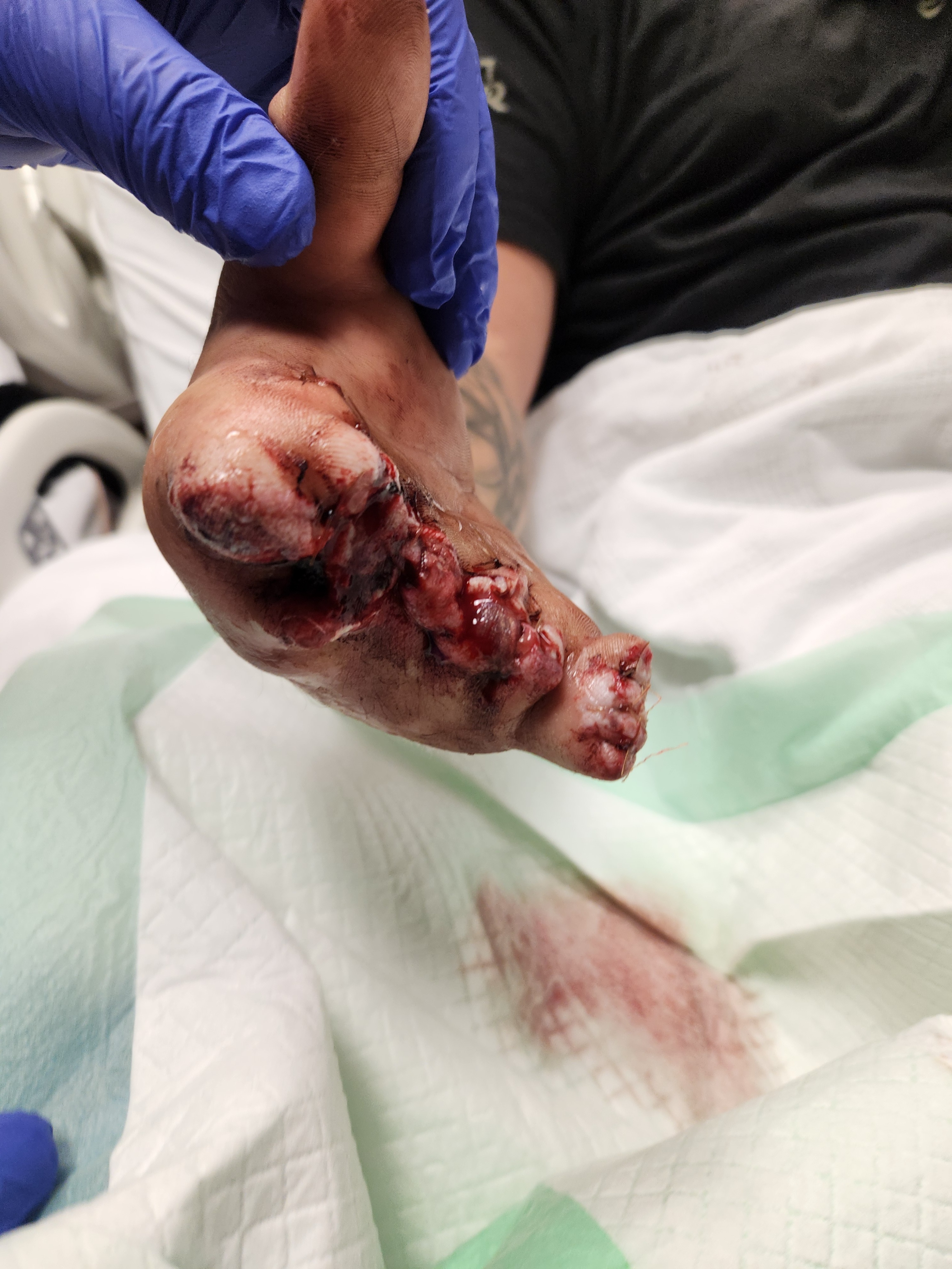 Donate to help Alex Heal from tragic injury! campaign photo, 7 of 8