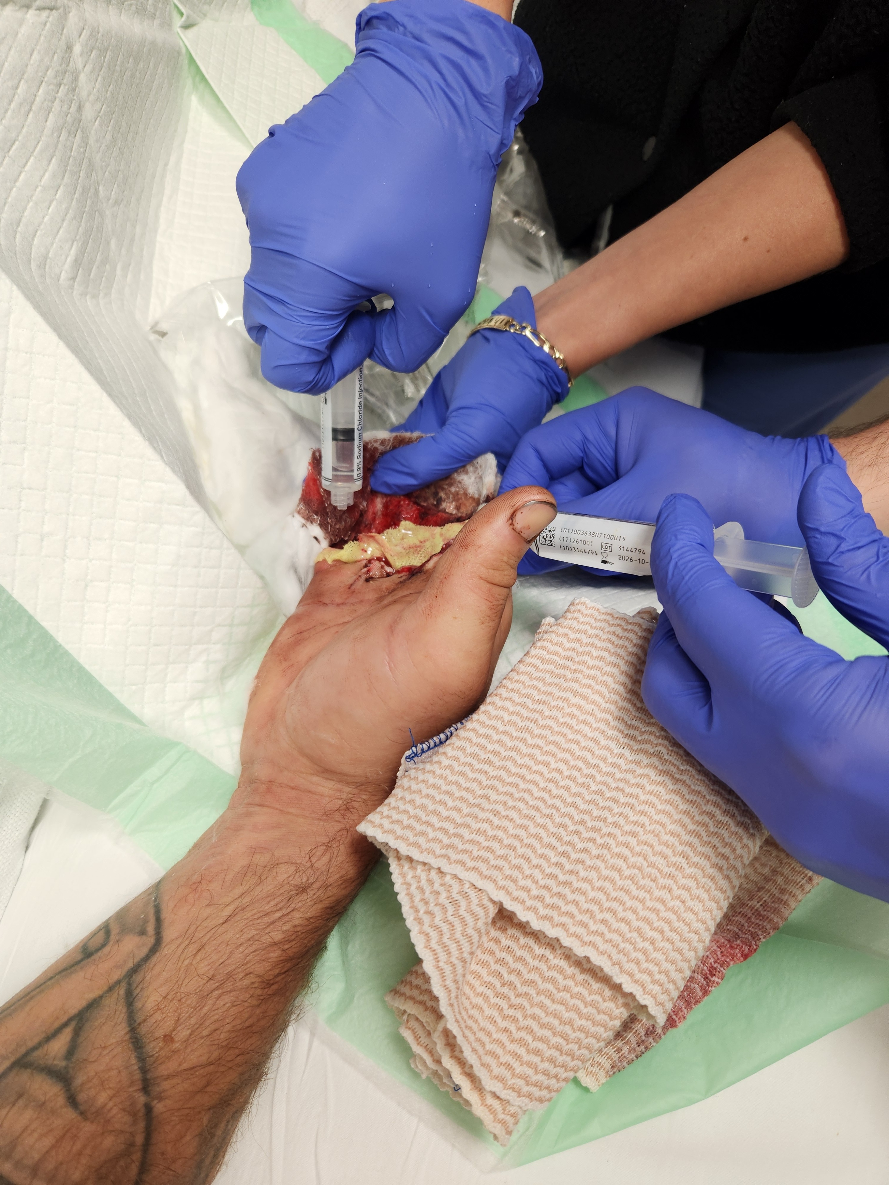 Donate to help Alex Heal from tragic injury! campaign photo, 2 of 8