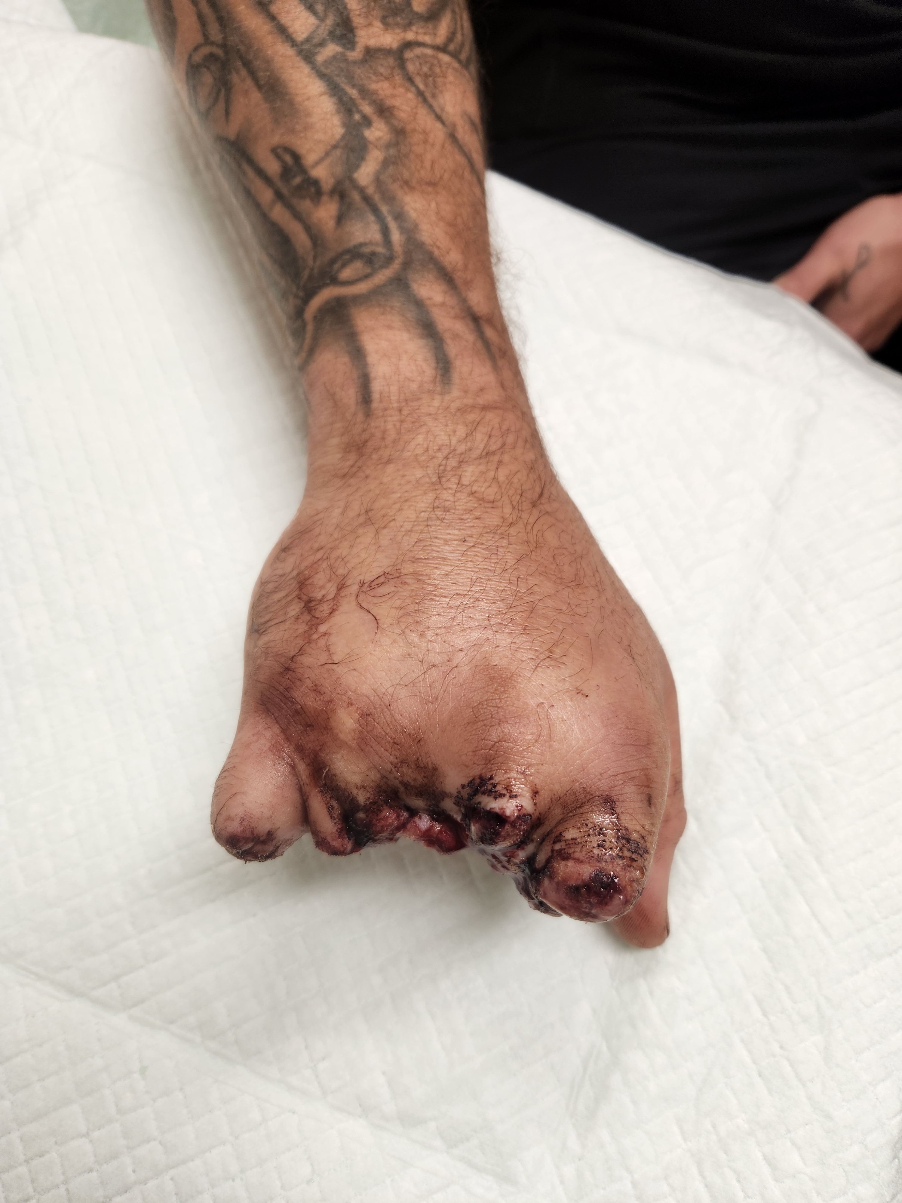 Donate to help Alex Heal from tragic injury! campaign photo, 5 of 8