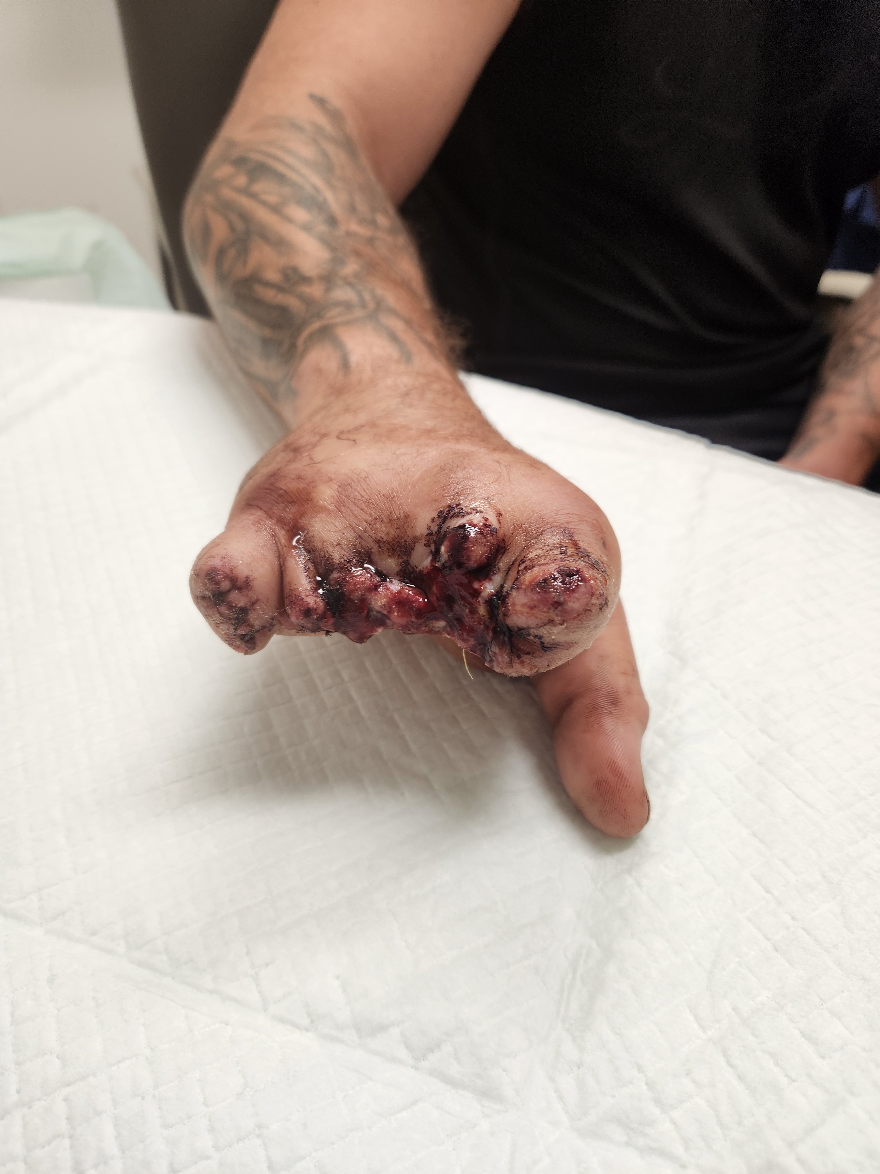 Donate to help Alex Heal from tragic injury! campaign photo, 6 of 8