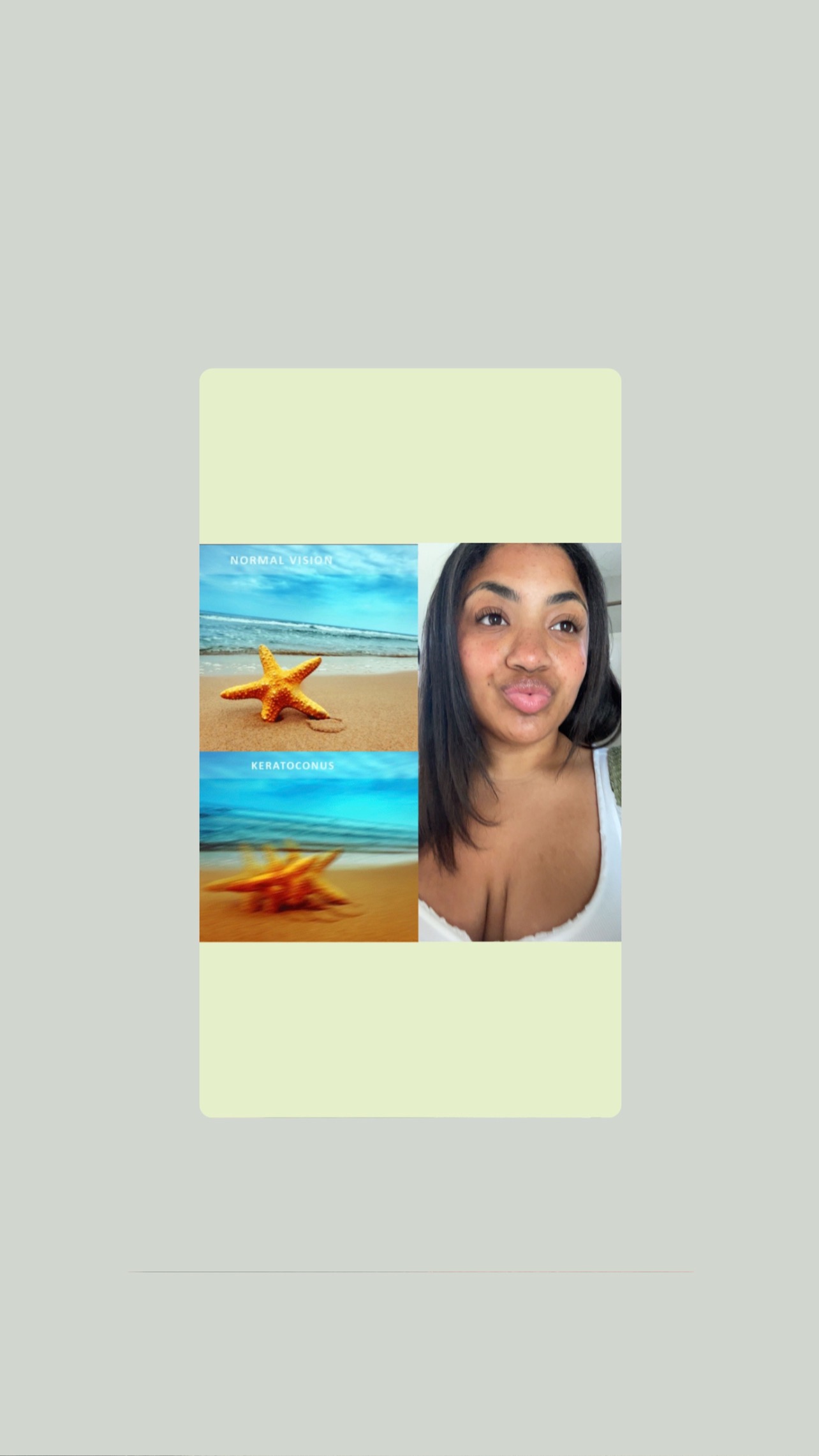 Help Ysabella Restore & Preserve Her Vision campaign photo, 2 of 4
