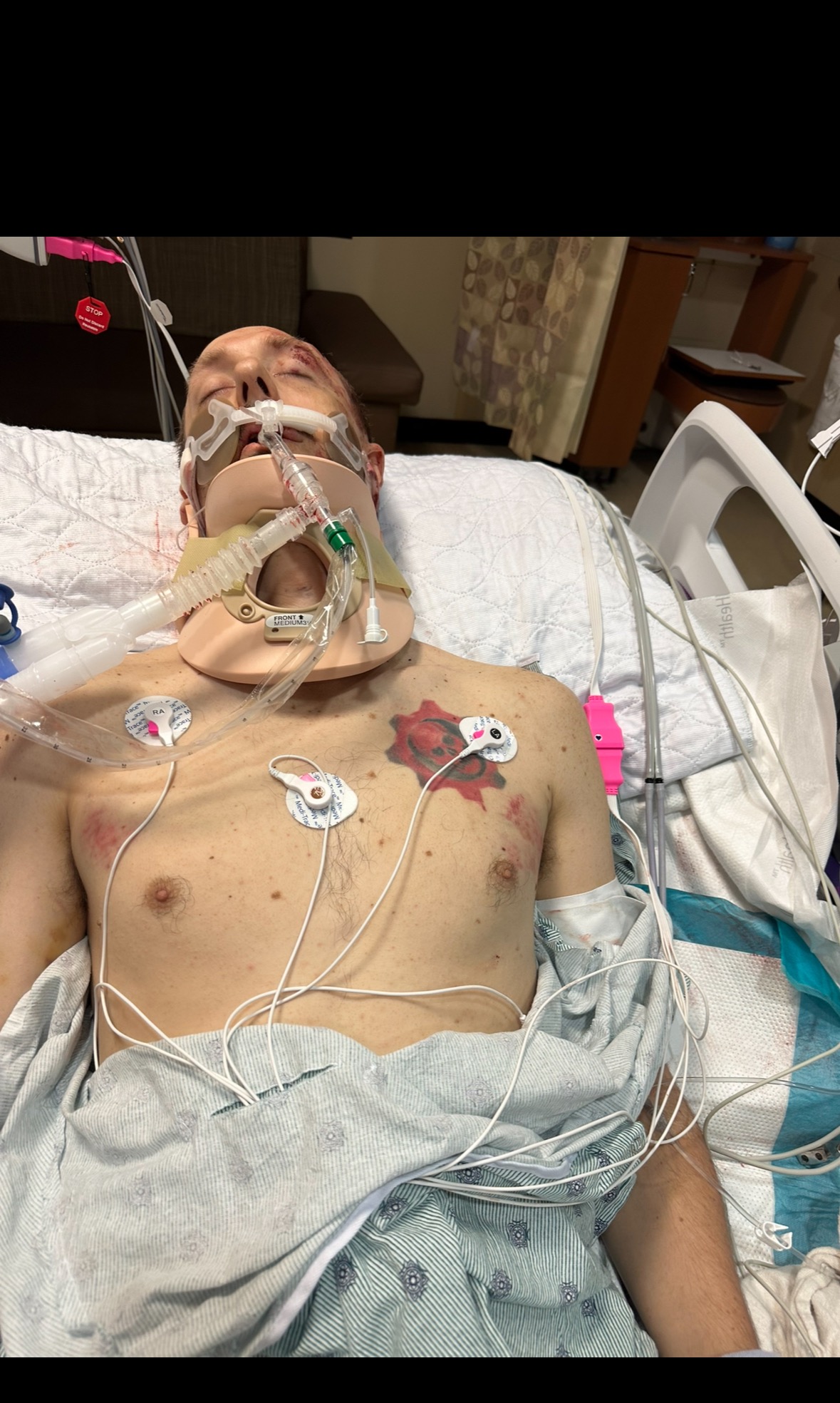 Help provide the care needed after a traumatic head injury campaign photo, 5 of 6
