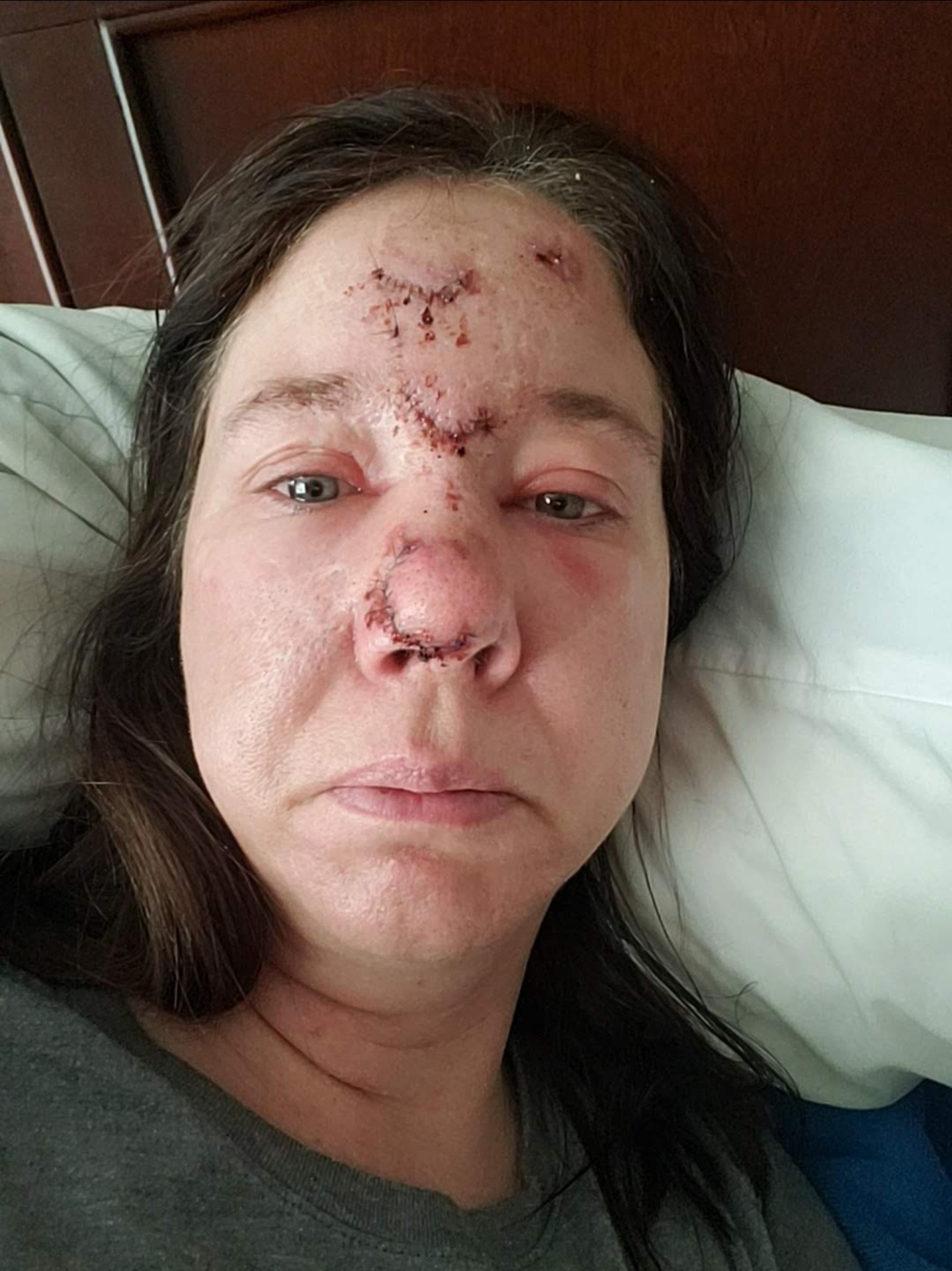 Help Brandi Get a Seizure Alert Service Dog campaign photo, 5 of 6