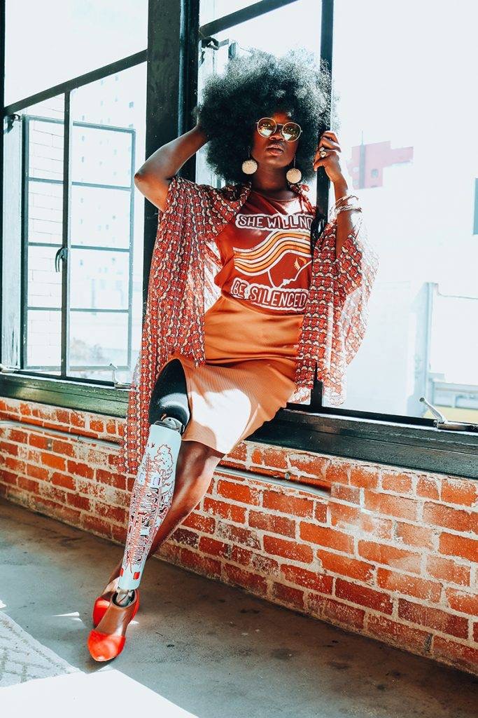 Help Adele Shine with Beautiful Prosthetic Covers campaign photo, 4 of 8
