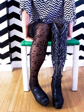Help Adele Shine with Beautiful Prosthetic Covers campaign photo, 2 of 8