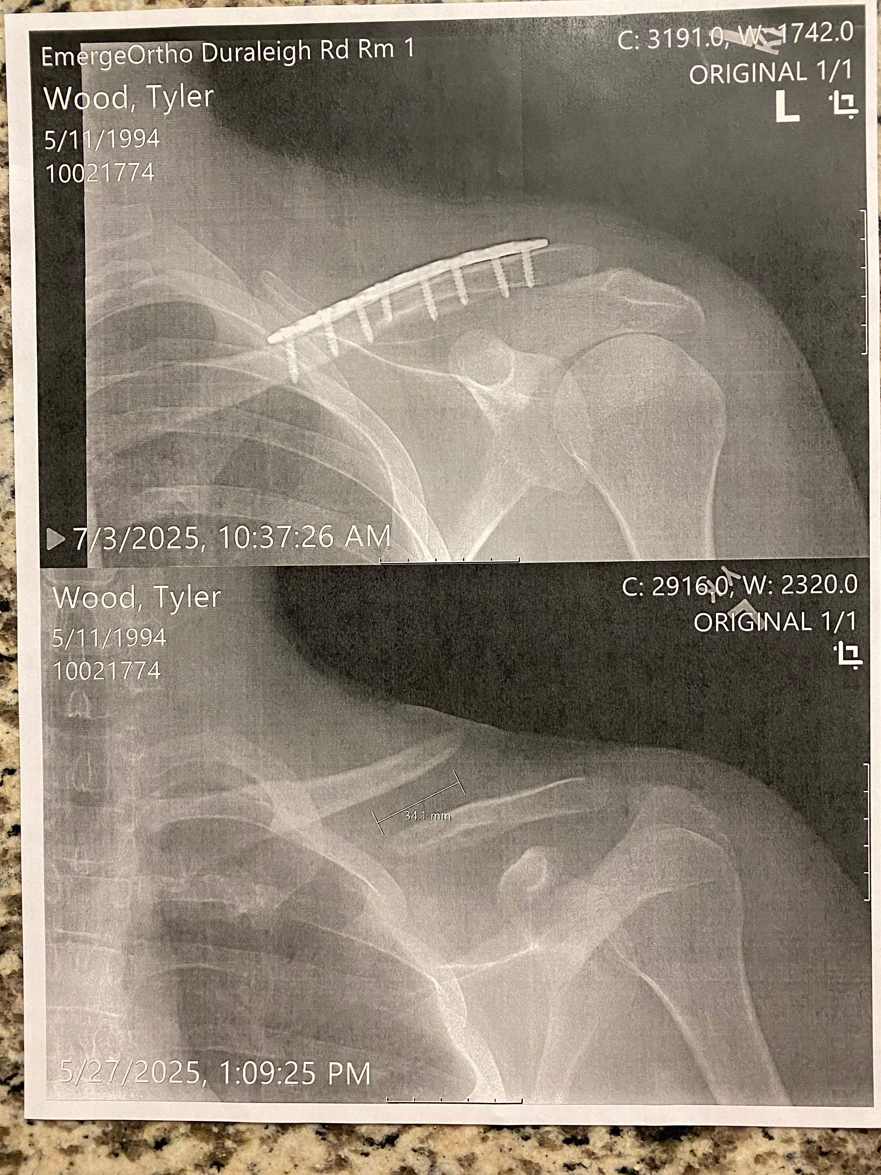 Tyler Broke His Collarbone and Needs Some Help campaign photo, 7 of 8