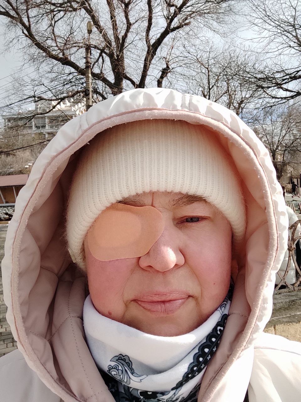 Help to save my mom’s eye, she needs a surgery in Ukraine. campaign photo, 2 of 8