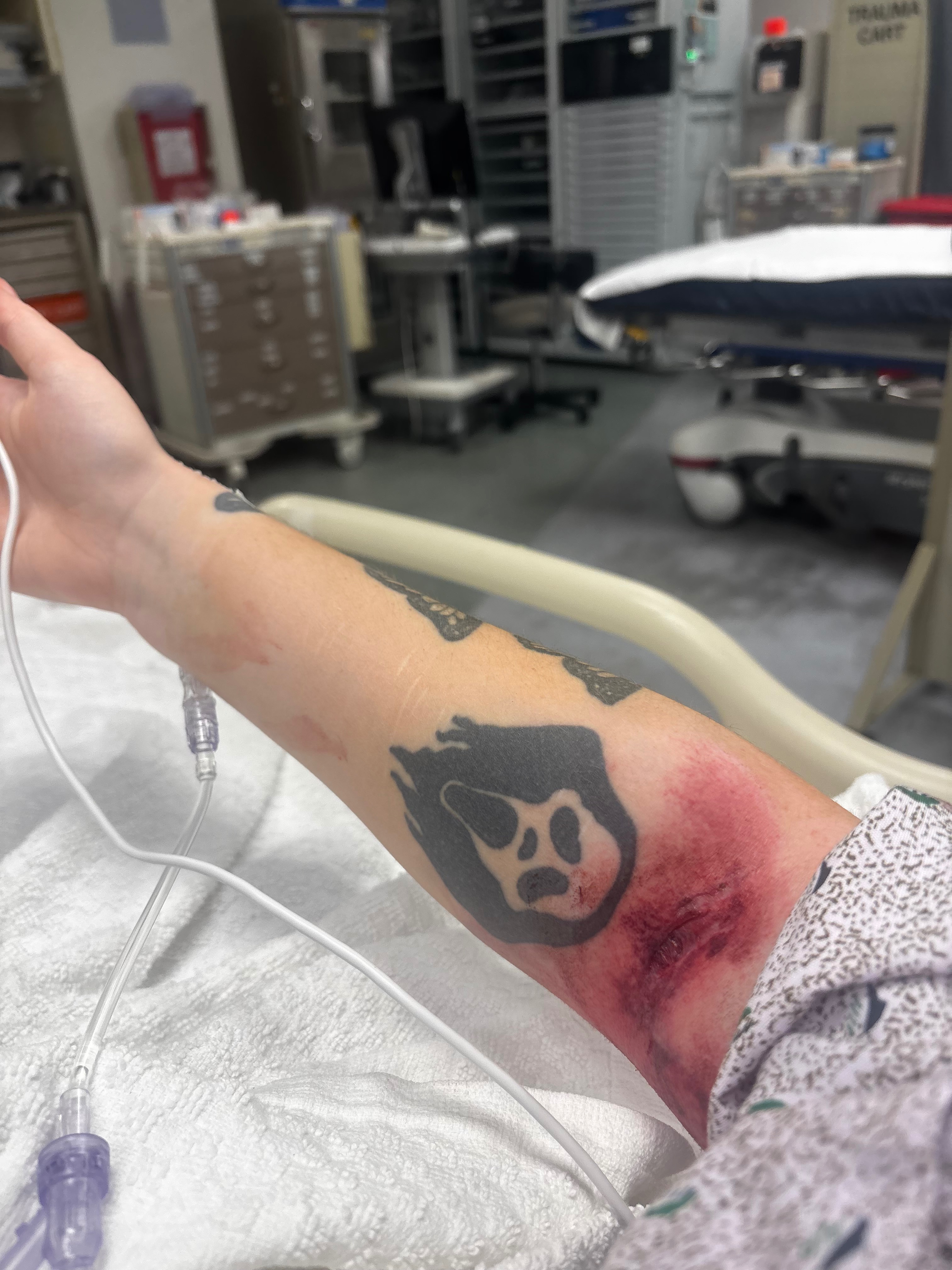 Help Me Recover From a Serious Car Accident campaign photo, 4 of 8