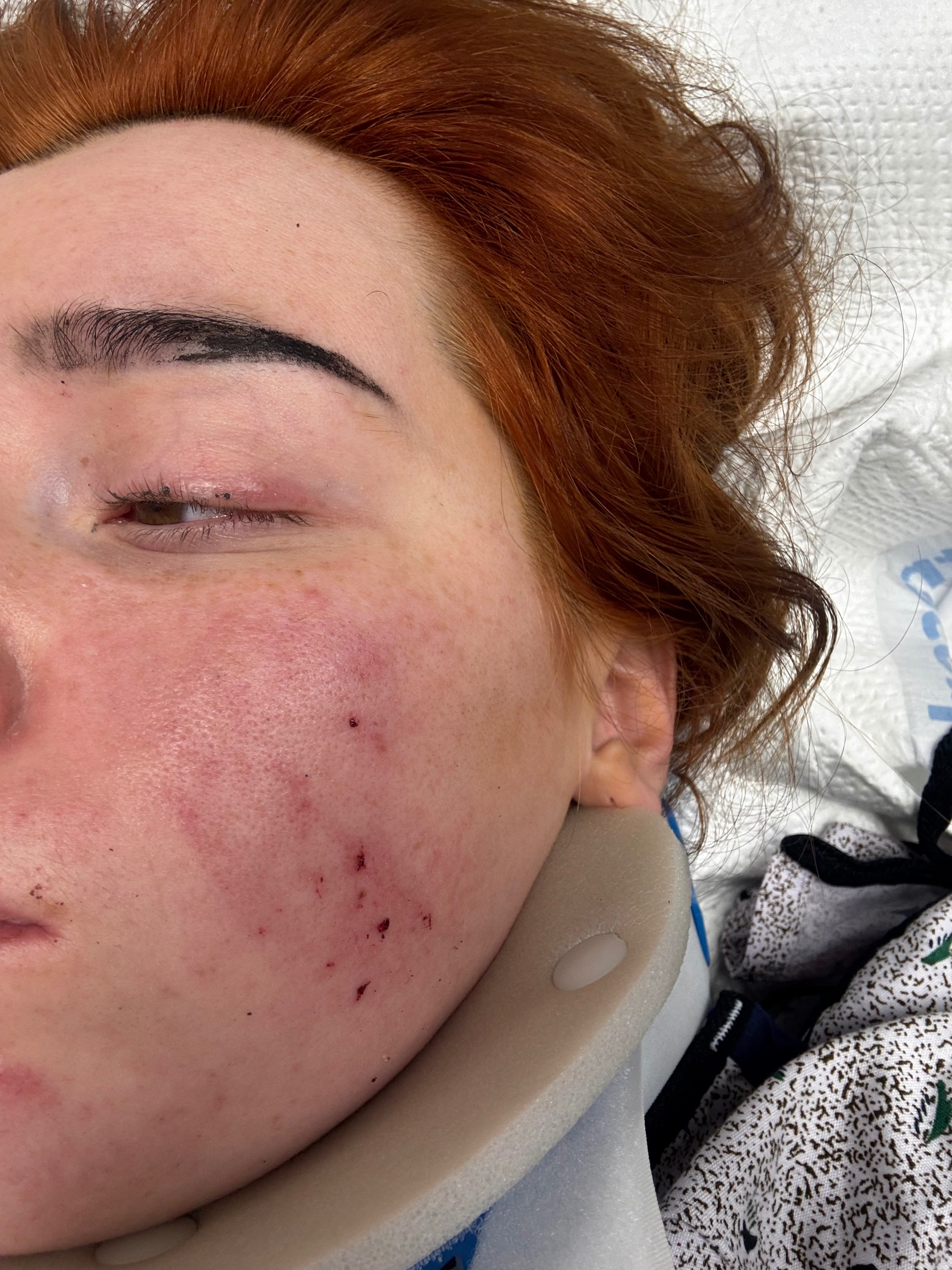 Help Me Recover From a Serious Car Accident campaign photo, 5 of 8