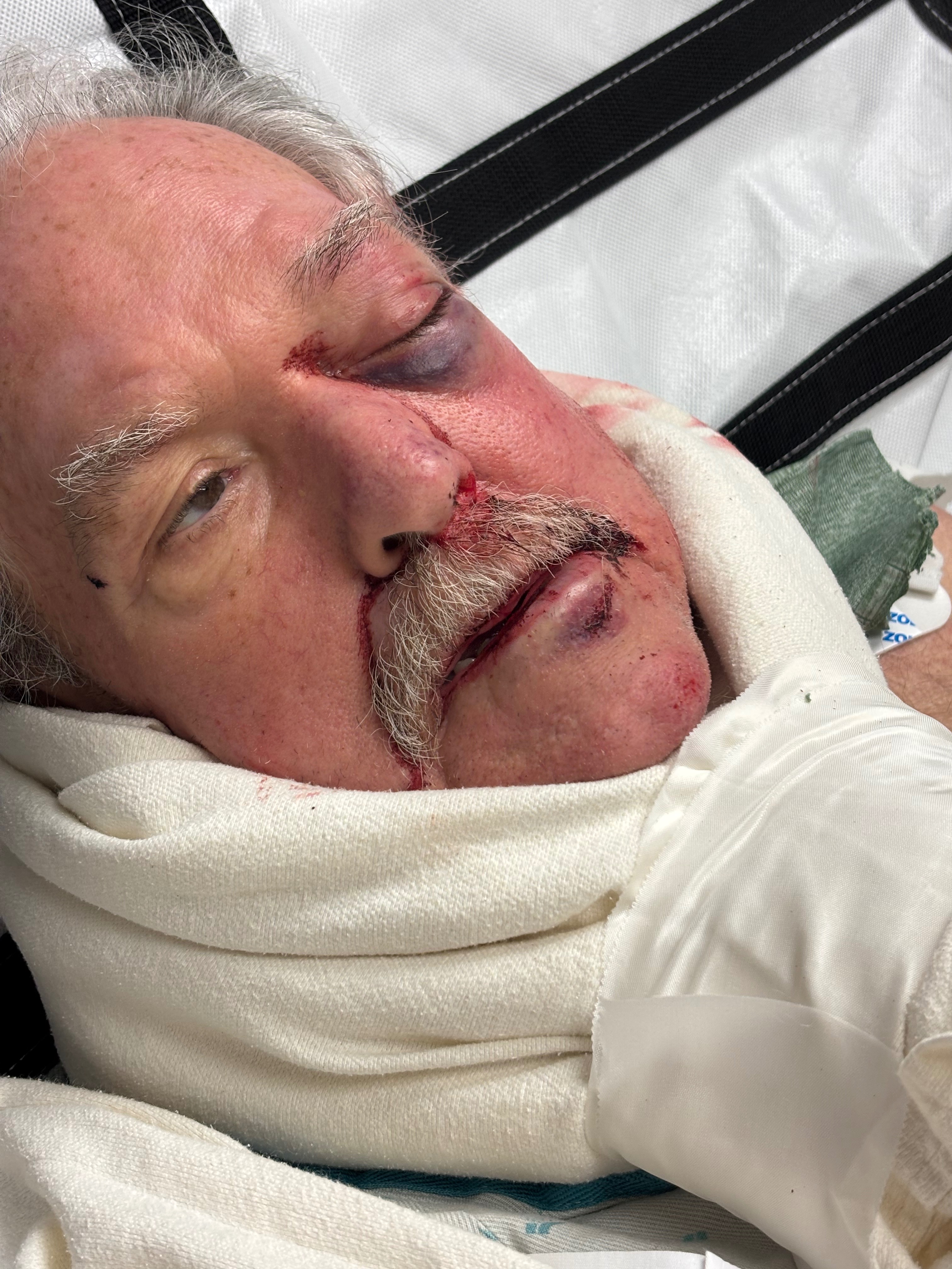 Aid Rick's Journey After Traumatic Fall campaign photo, 7 of 8