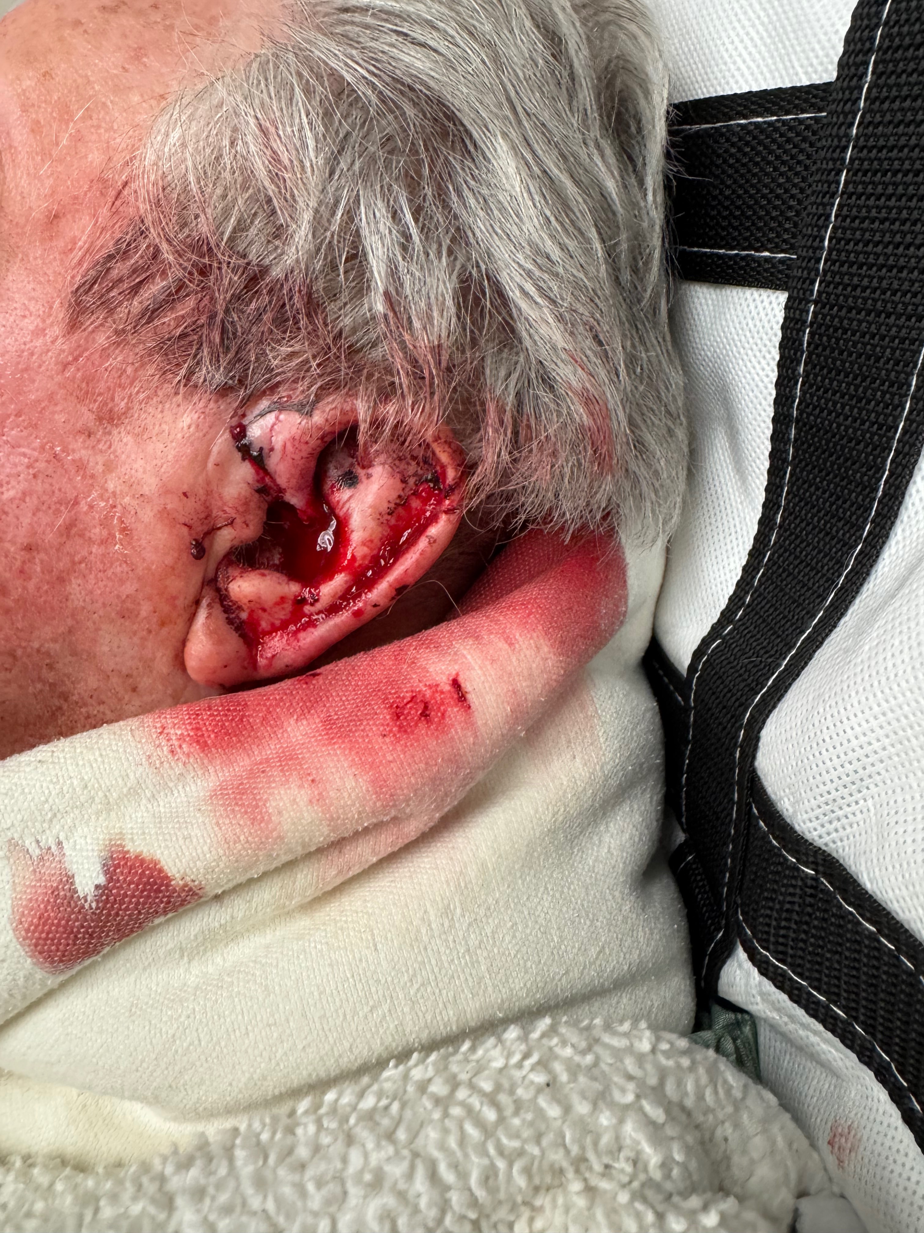 Aid Rick's Journey After Traumatic Fall campaign photo, 2 of 8