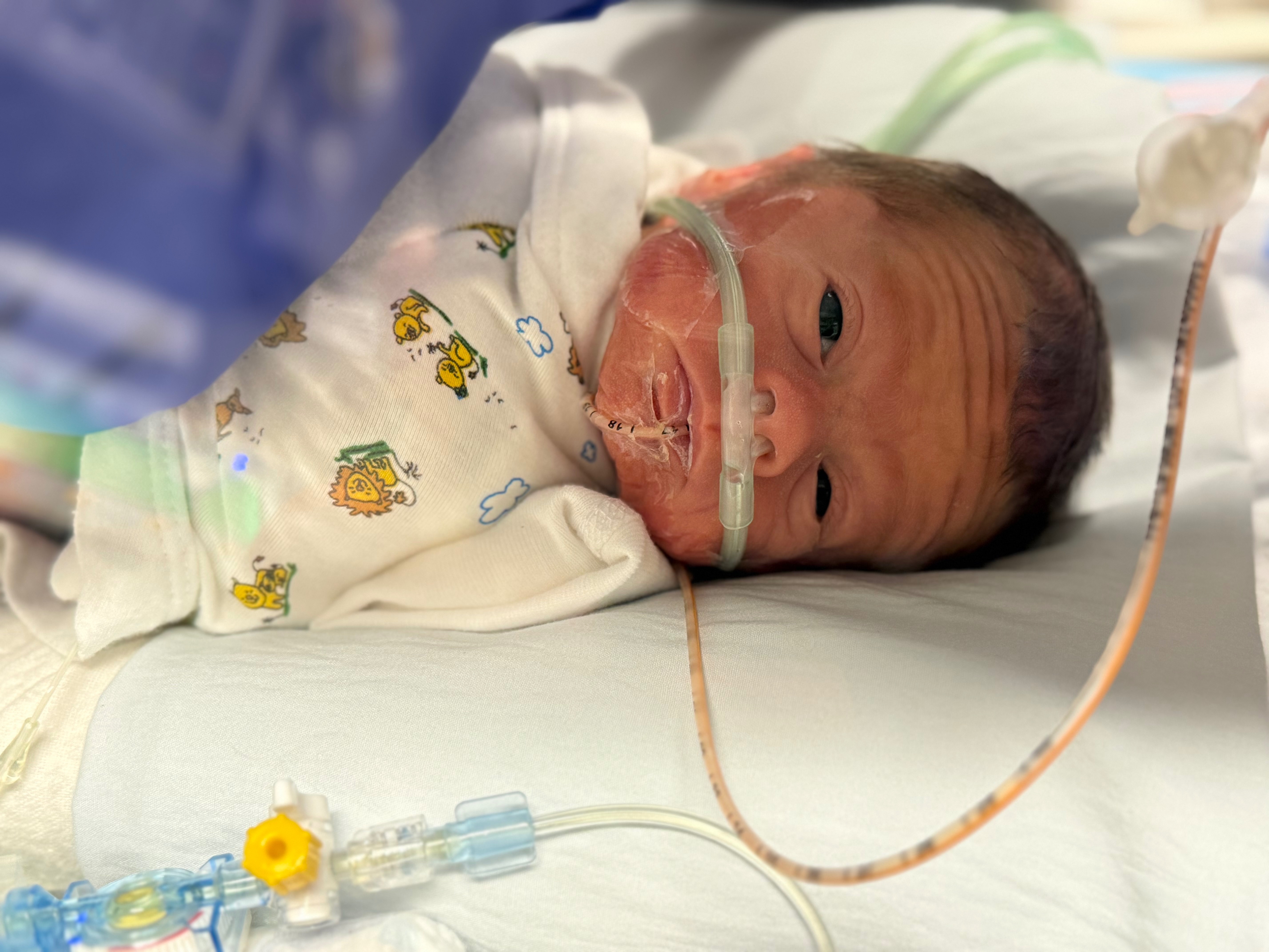 Mighty Mack: The Cutchin Family NICU Support Fund campaign photo, 7 of 8