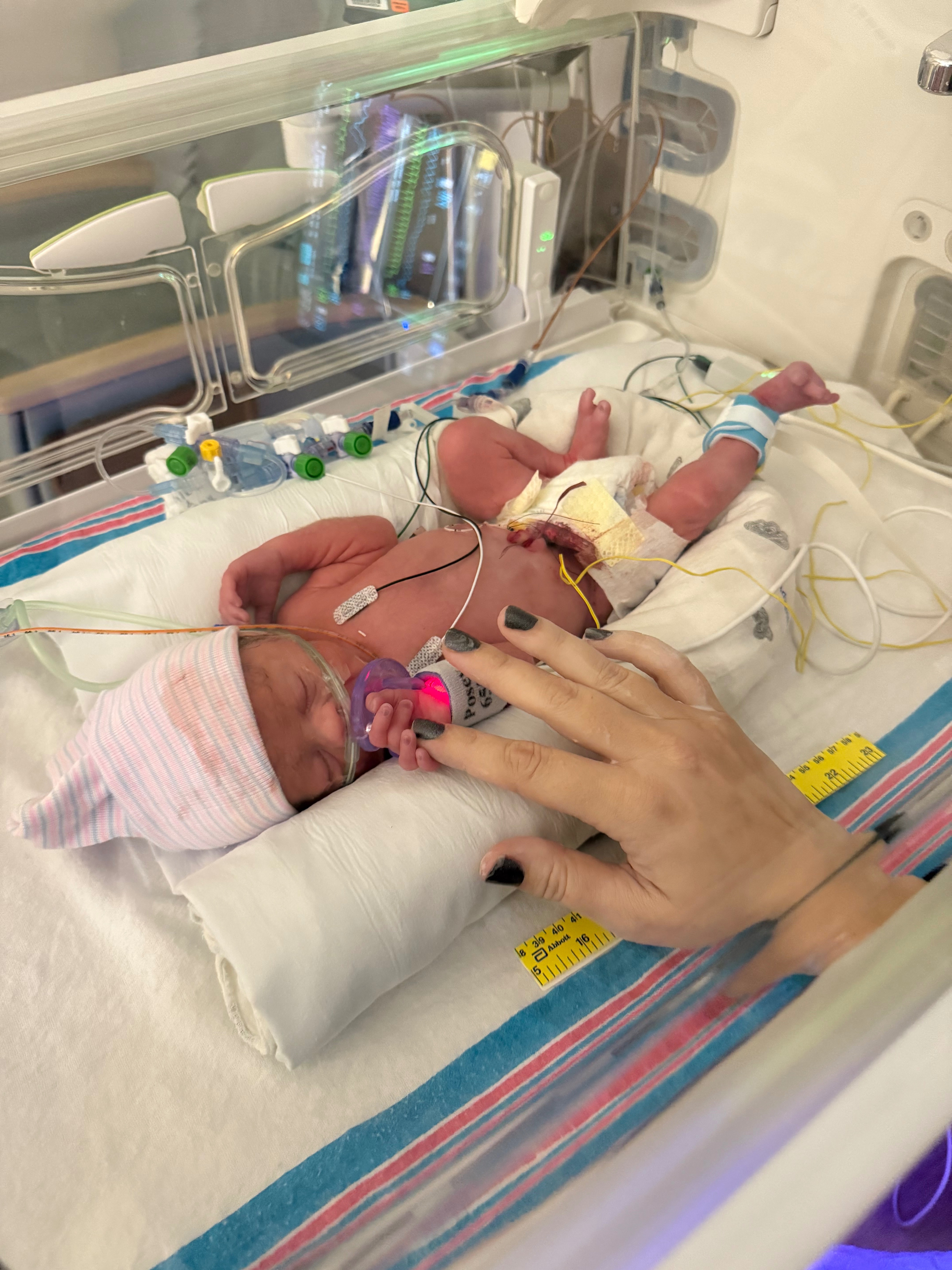 Mighty Mack: The Cutchin Family NICU Support Fund campaign photo, 2 of 8