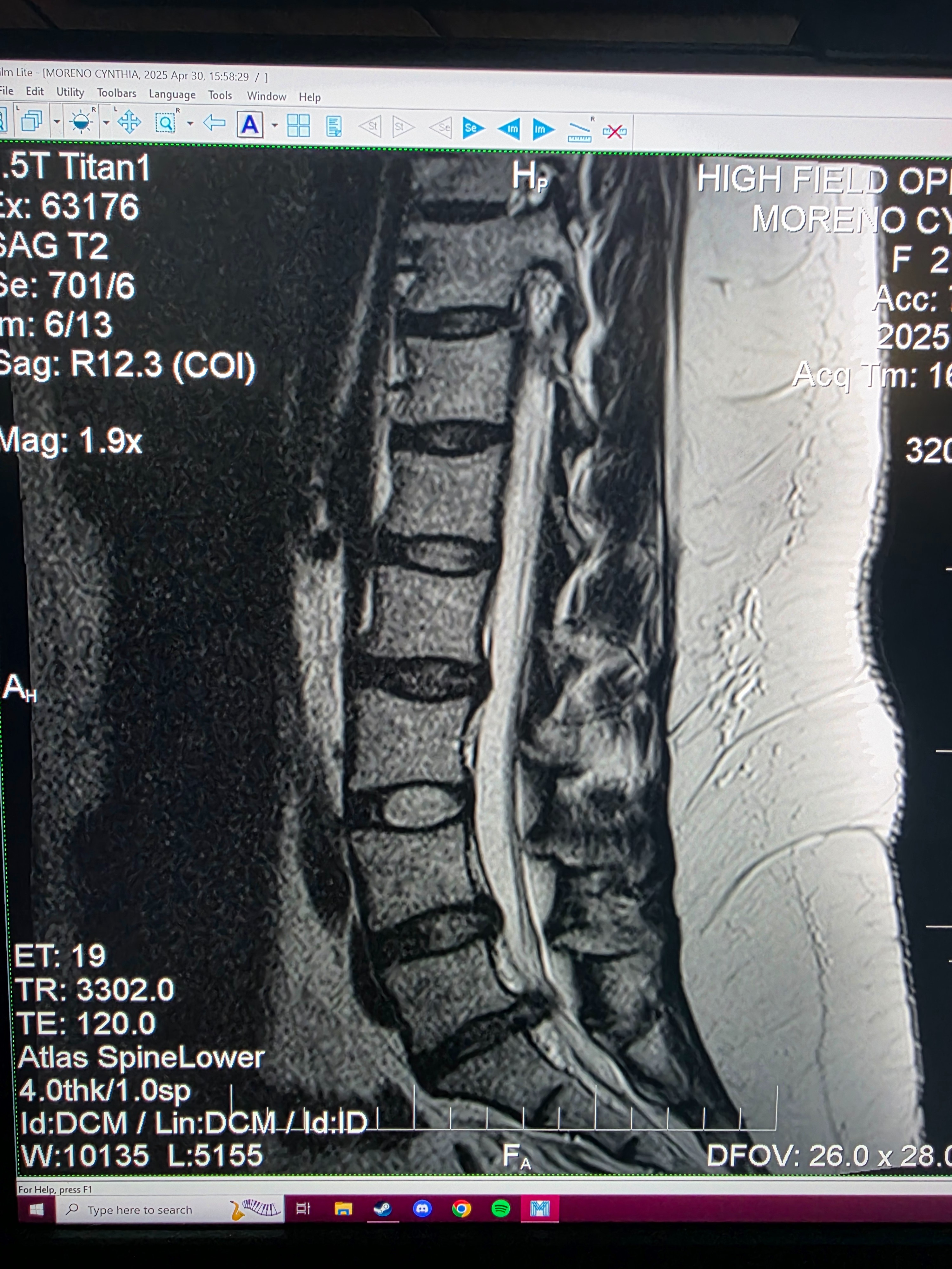 Urgent Surgery Needed for Herniated Disc campaign photo, 4 of 5