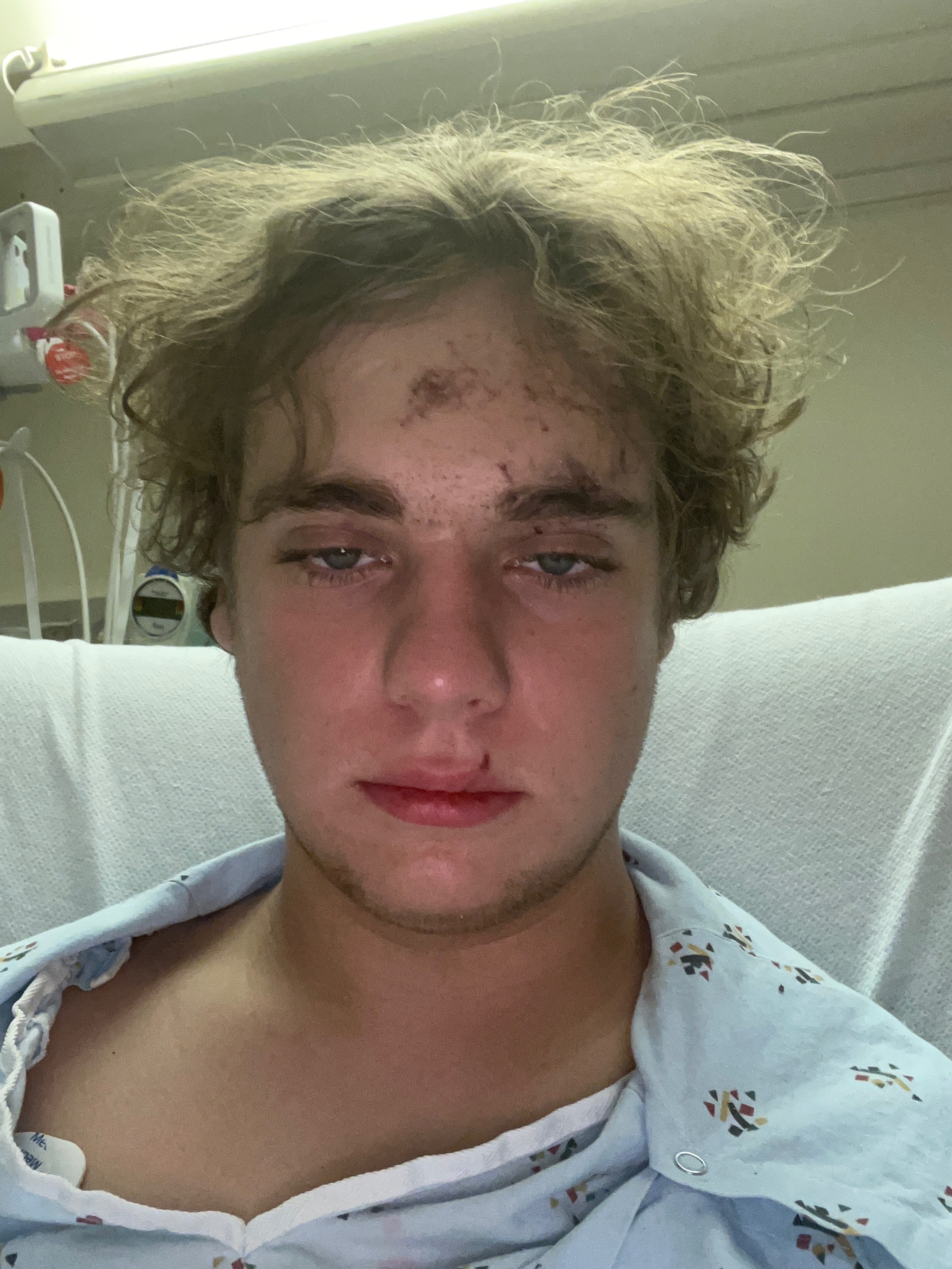 Support 17-Year-Old's Recovery from Crash campaign photo, 4 of 5