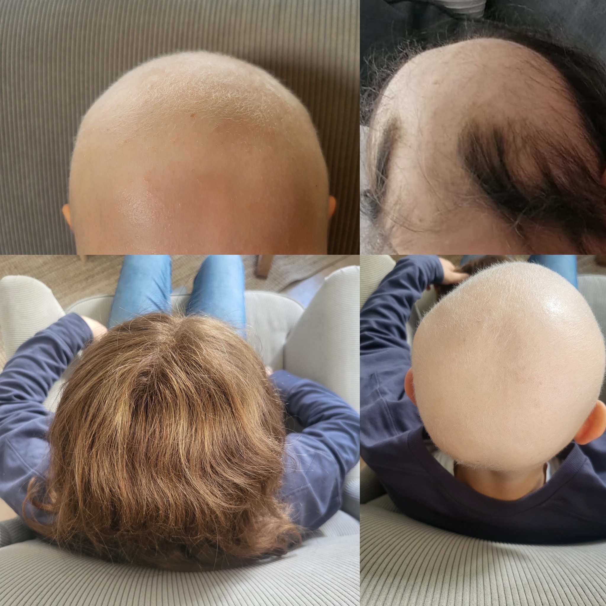 Ein Stück Kindheit zurück – für unsere tapfere Tochter campaign photo, 2 of 4