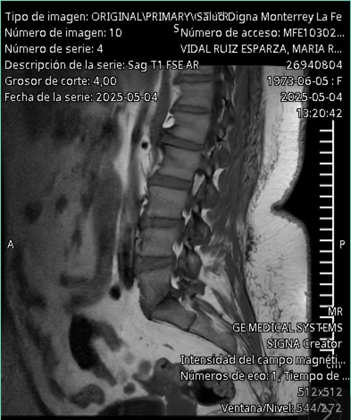 Solicito donadores para mi primera cirugía de columna campaign photo, 5 of 7