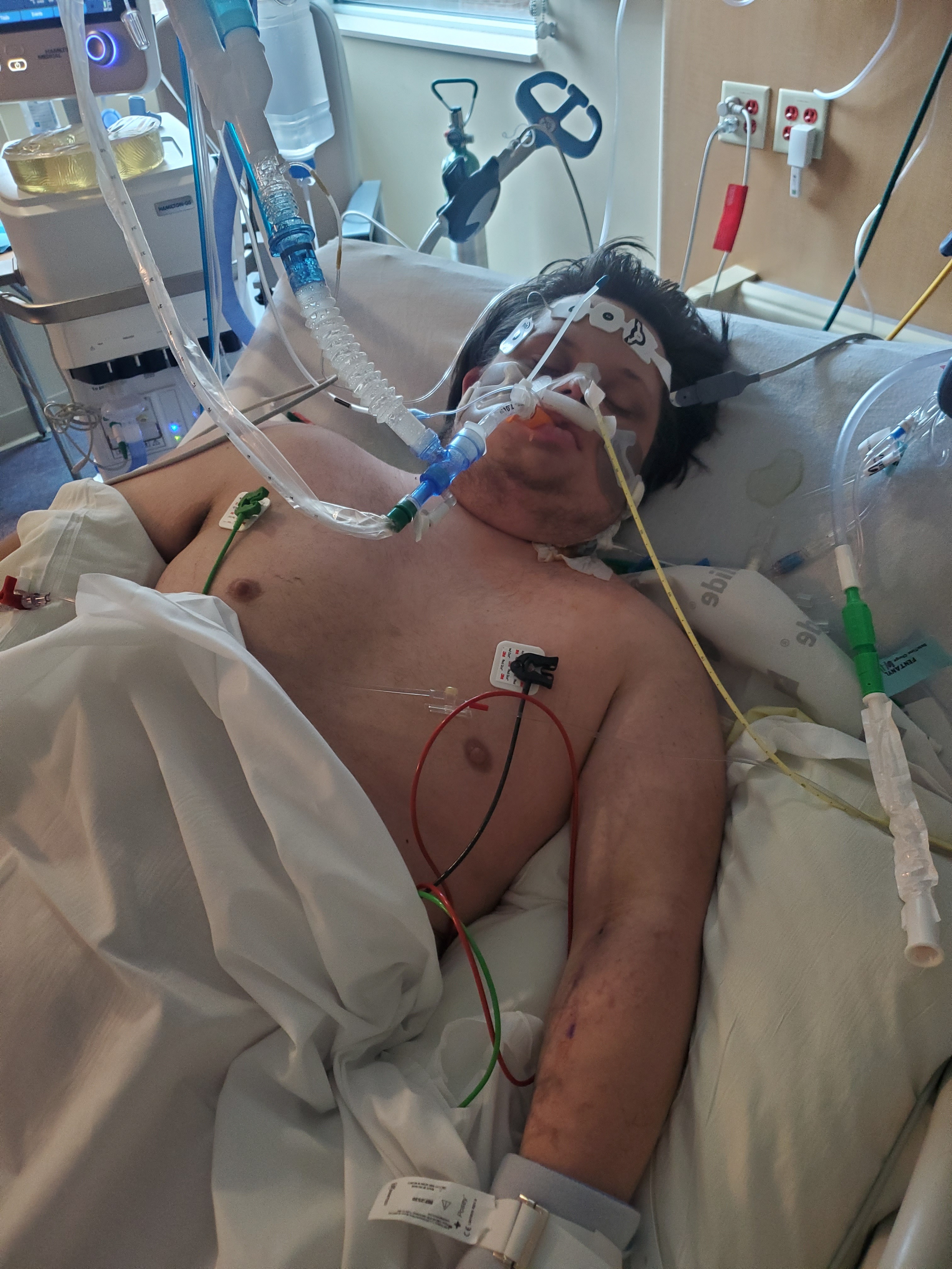 Help Support Jesse's Fight Against Pneumoni campaign photo, 4 of 5