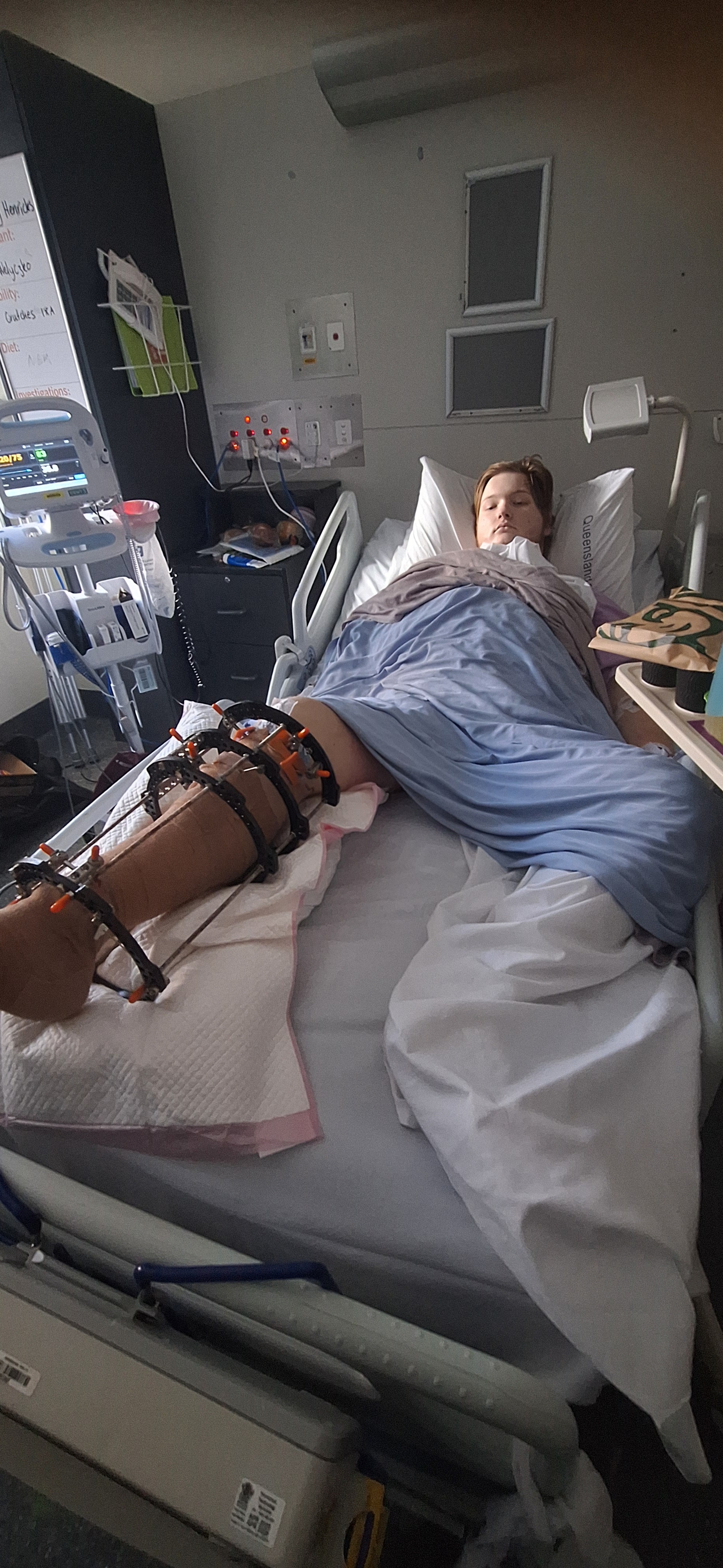 Help to get my son home from hospital back to our home campaign photo, 4 of 8