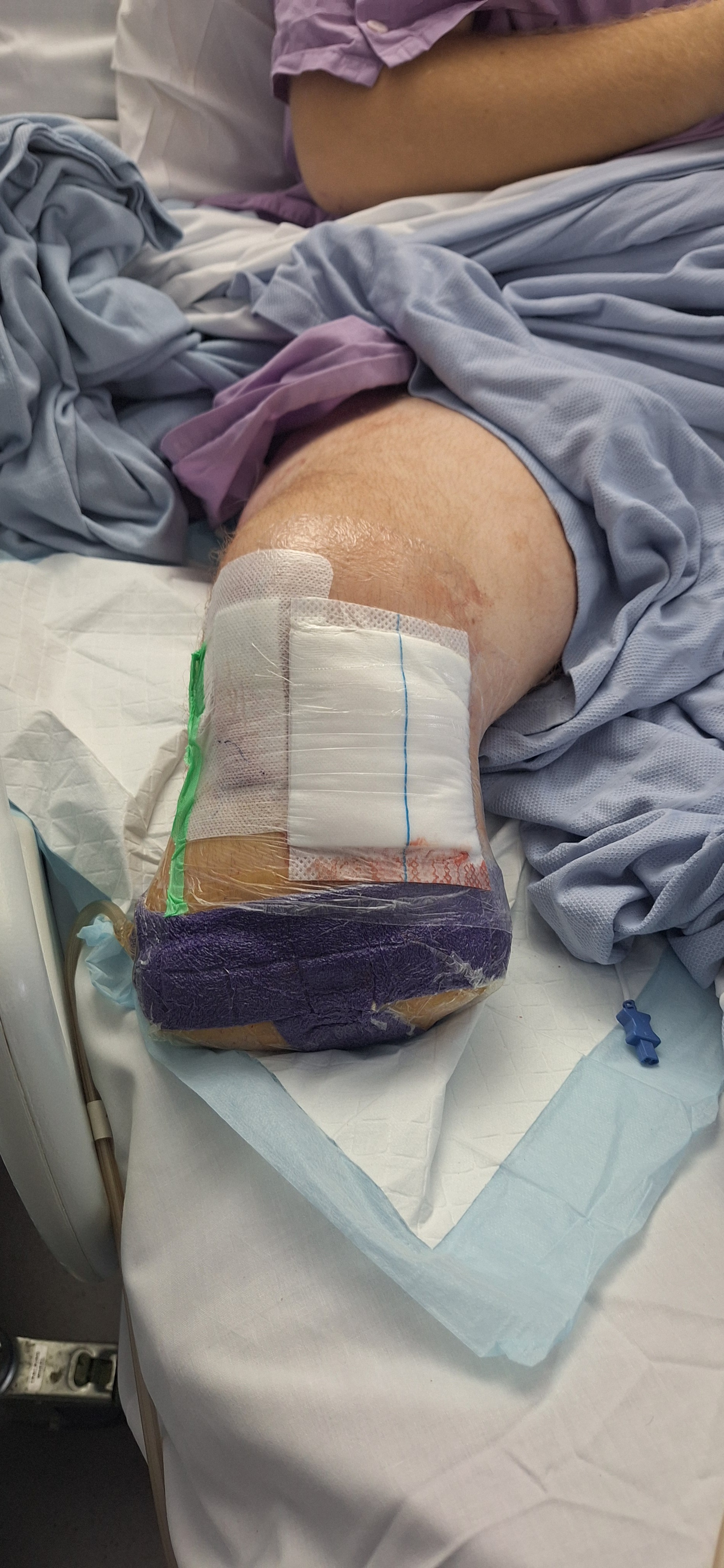 Help to get my son home from hospital back to our home campaign photo, 5 of 8