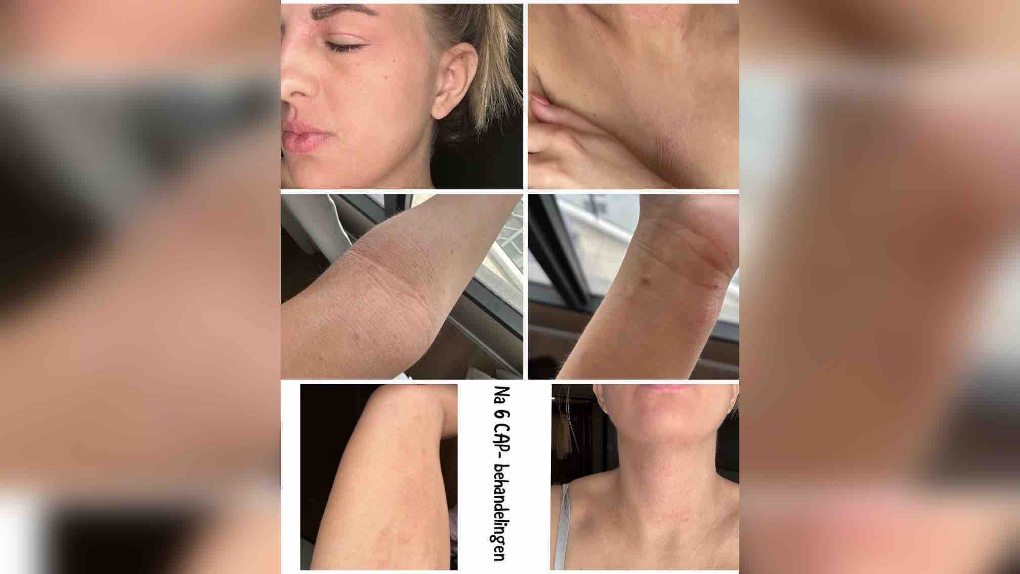 Fundraiser by Gina Van Heel : Licht-aan-het-eind-van-TSW - help me erheen, image size:2016x1134