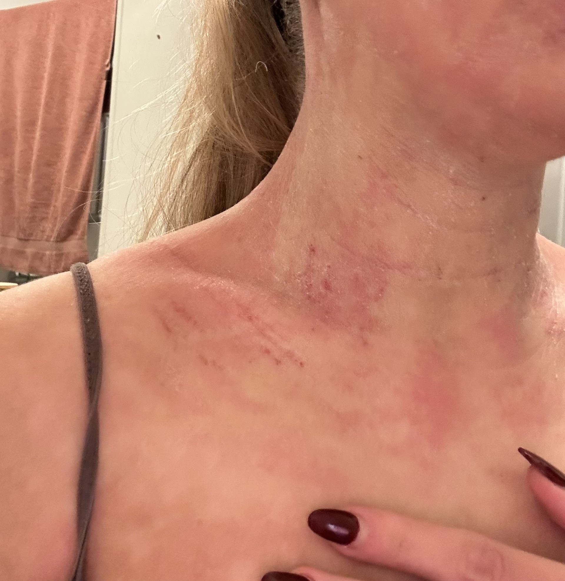 Fundraiser by Gina Van Heel : Licht-aan-het-eind-van-TSW - help me erheen, image size:1920x1974