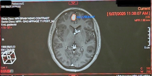 Support Becky’s Battle Against Brain Tumor campaign photo, 7 of 8